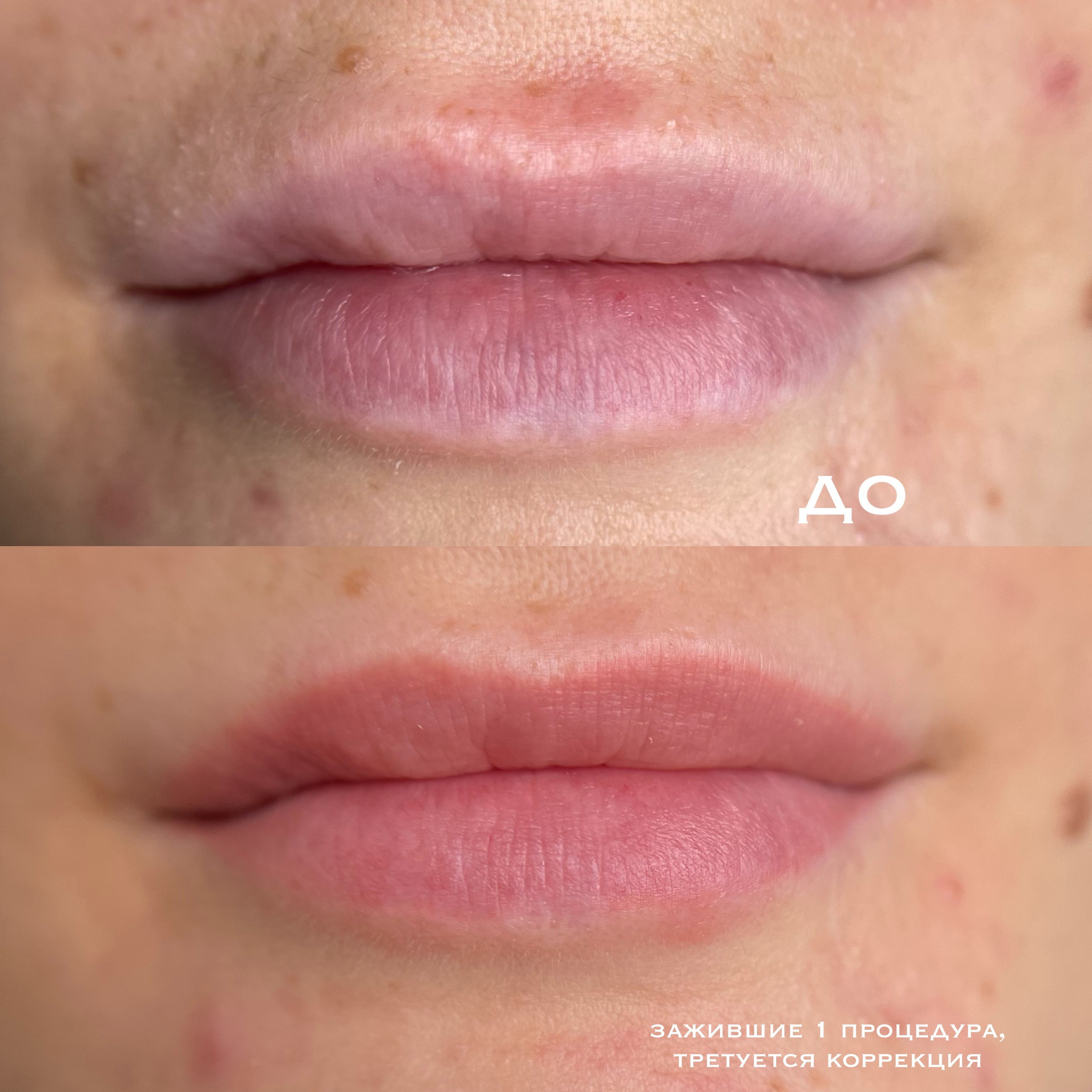 ГУБЫ зажившие. Перманентный макияж и удаление старого татуажа в Ростове-на-Дону Дарья Исакова