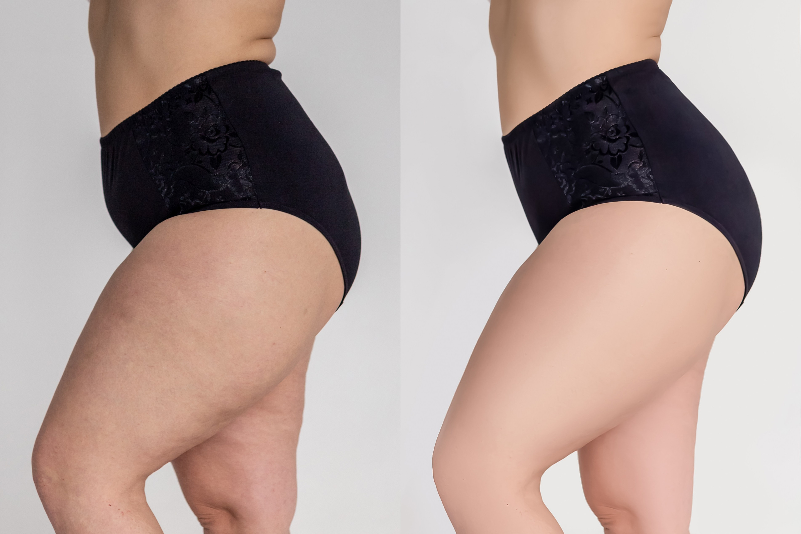 Деликатная обработка портретов для рекламы нижнего белья | Студия SVITHART