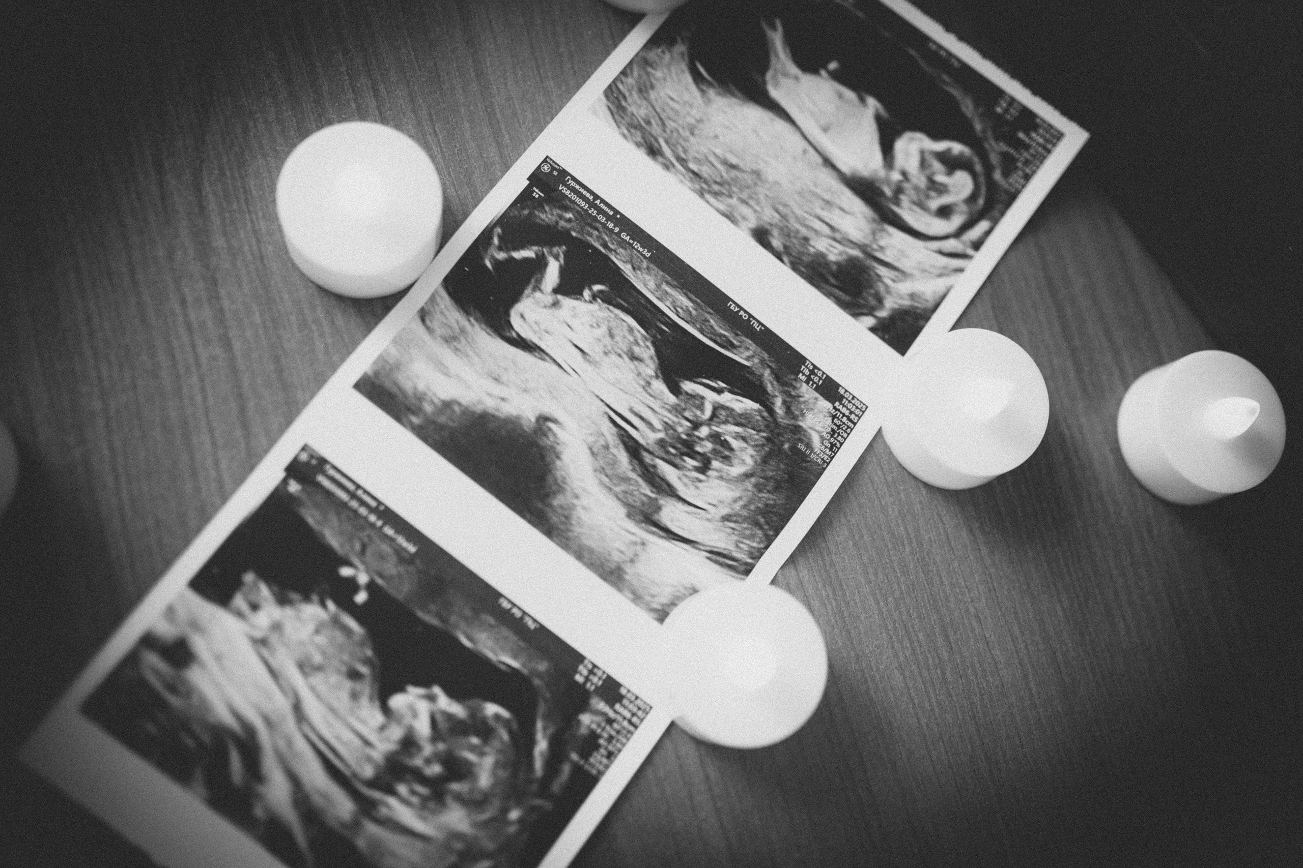 Рождение Нинэль. Семейный фотограф и фотограф на роды в Ростове-на-Дону Мухина Виктория