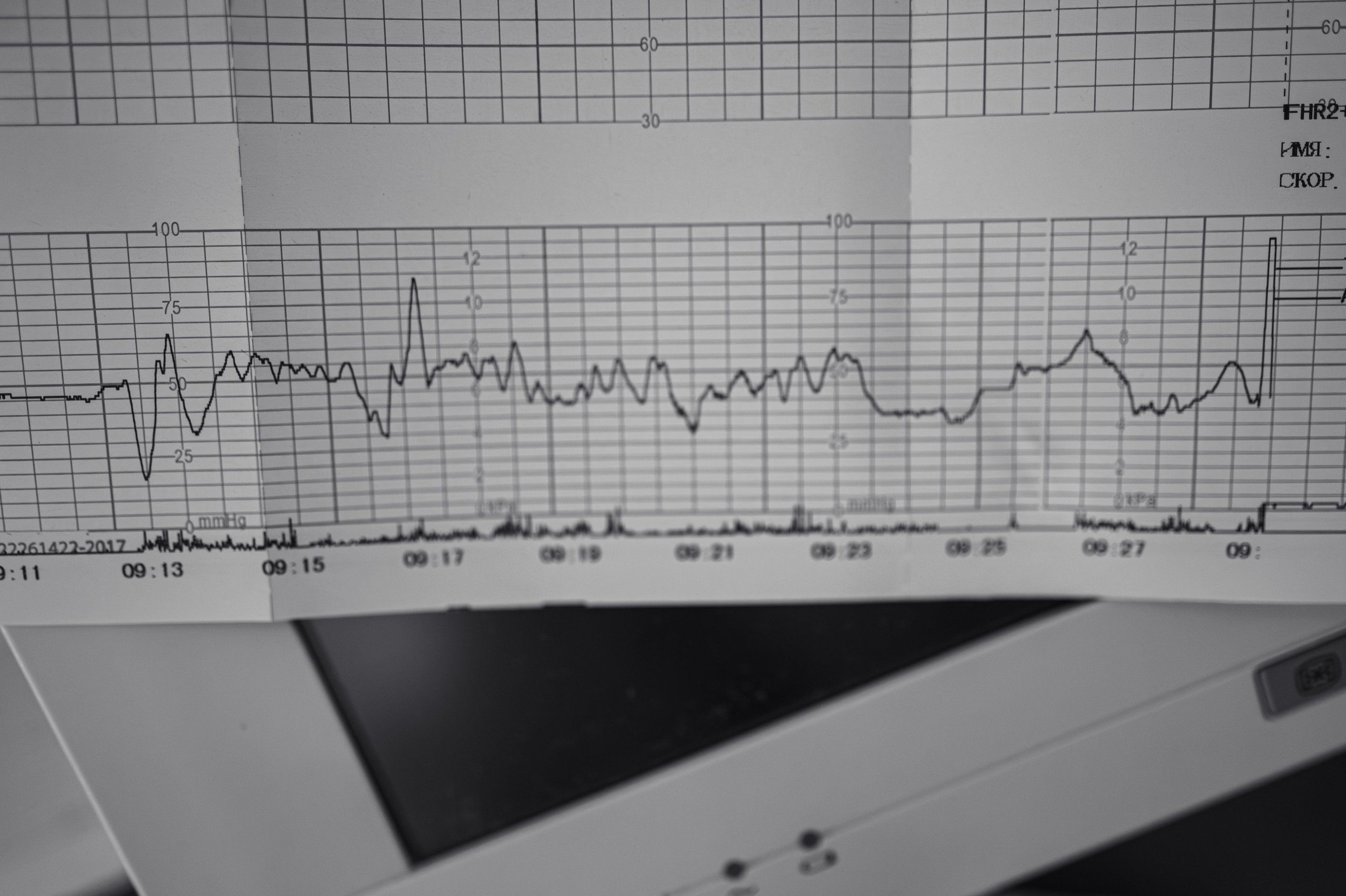 Хонор Хонорович родился в МД Лахта / Лешуков С. В. / Никитина Е. Фотограф на роды СПБ Юлия Герасимова
