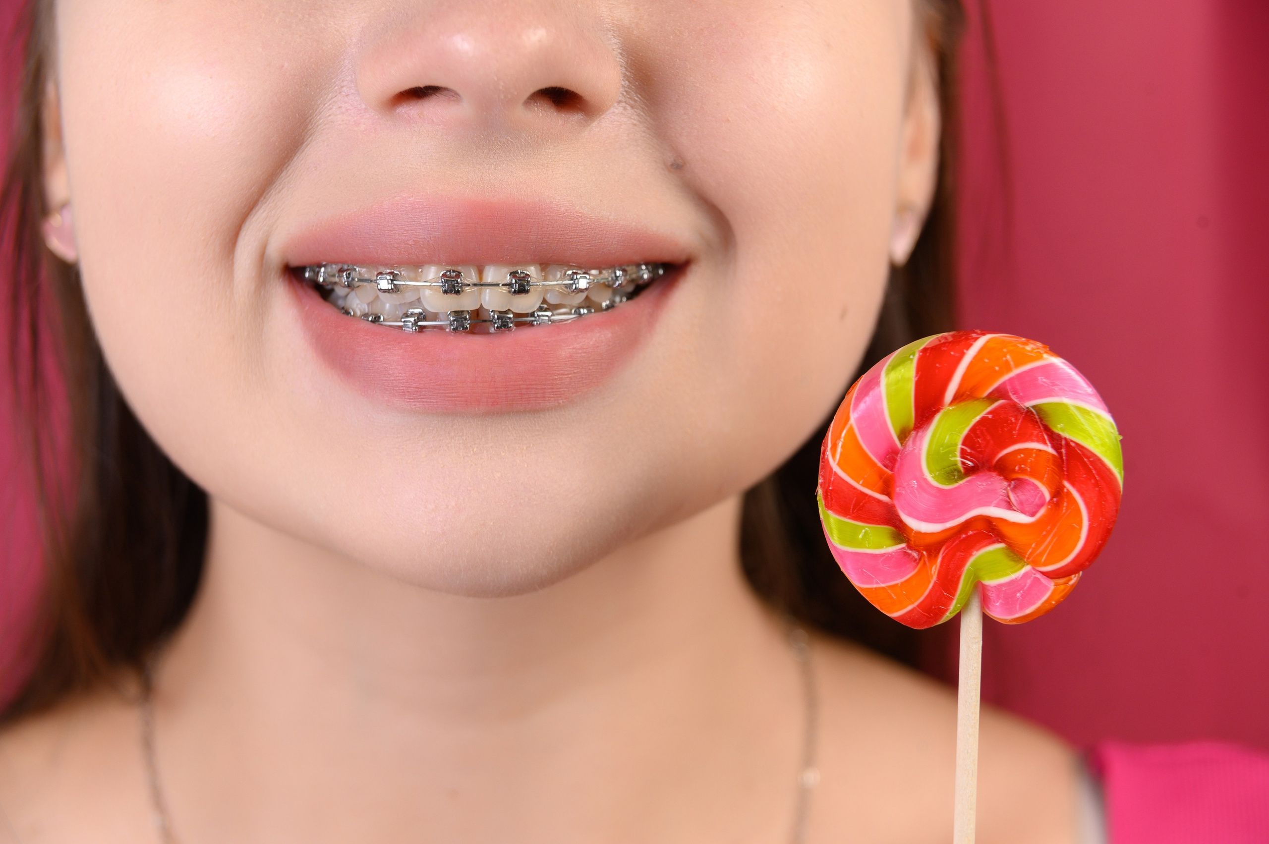 Профессиональная фото и видео съемка стоматологии. Виниры