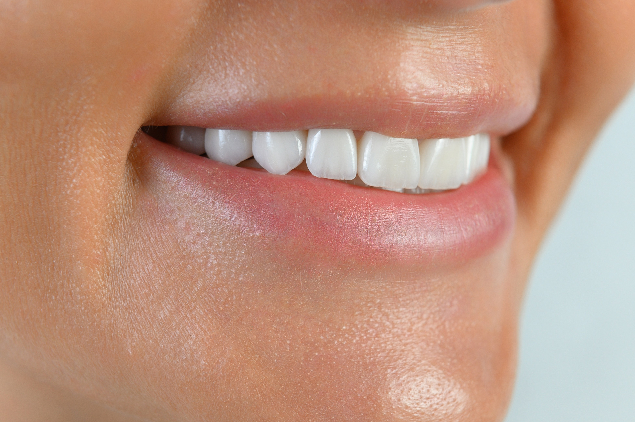 Профессиональная фото и видео съемка стоматологии. Виниры