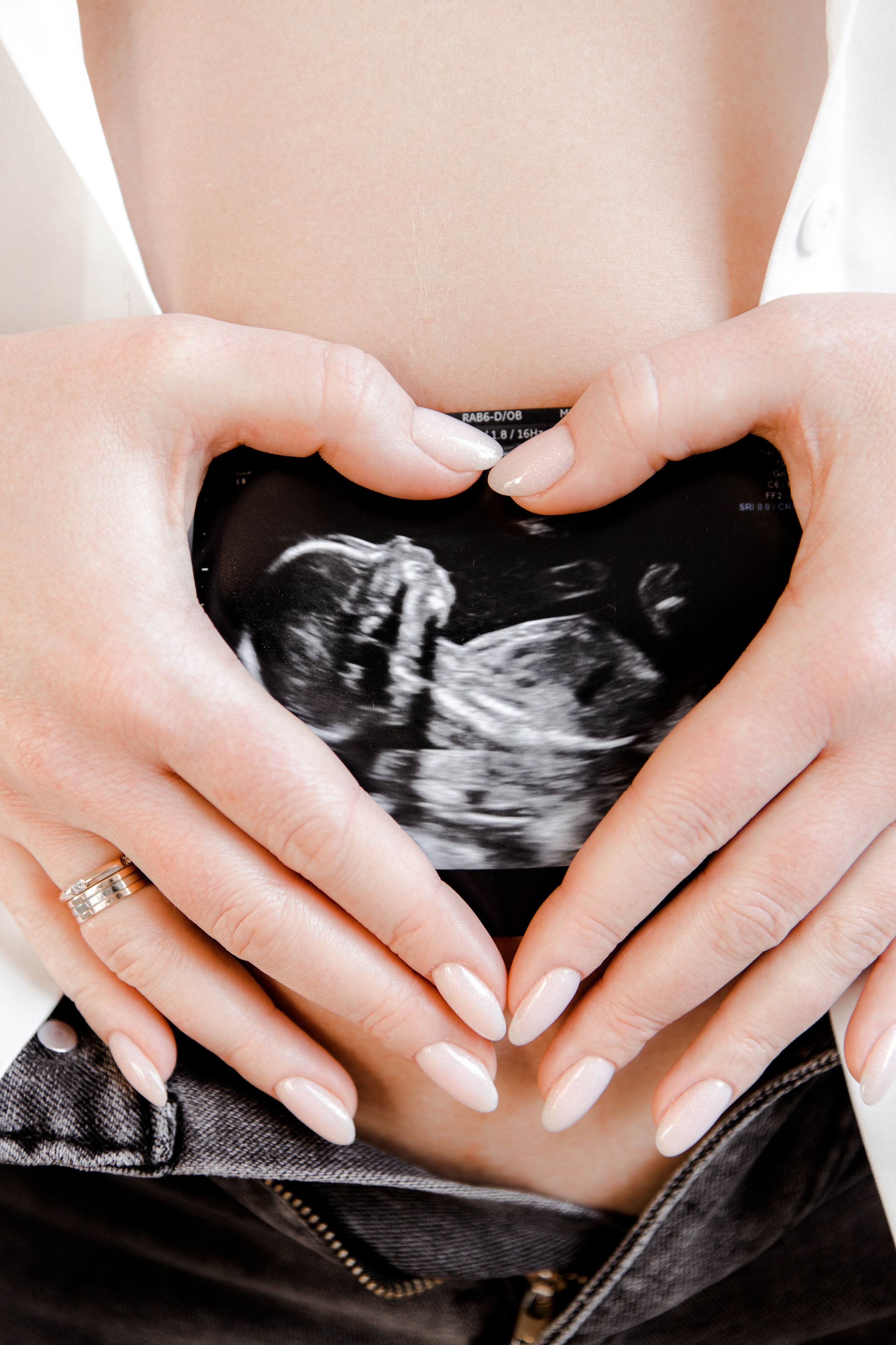 Женя и Коля. Свадебный фотограф в Воронеже Вероника Богай