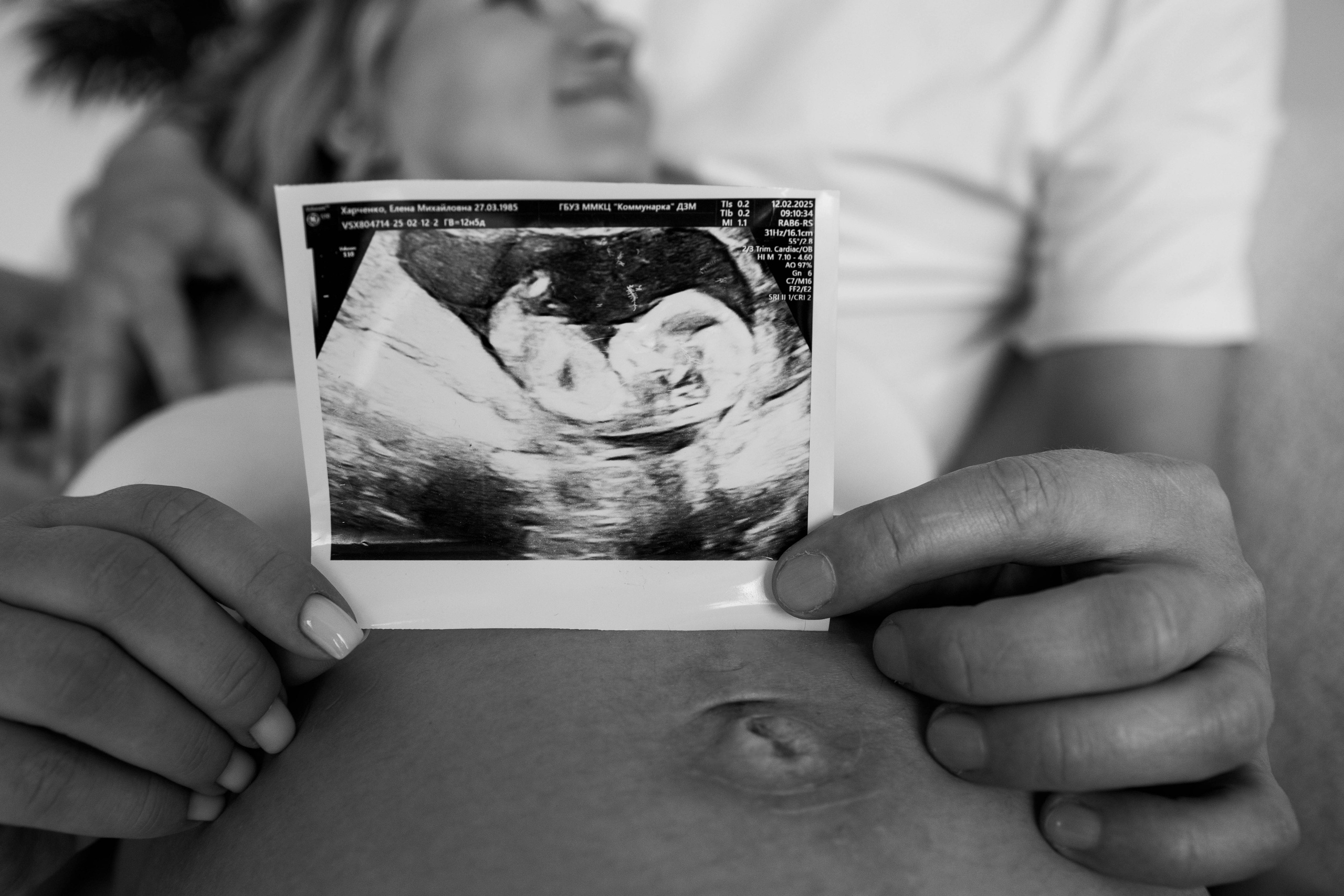 Беременность