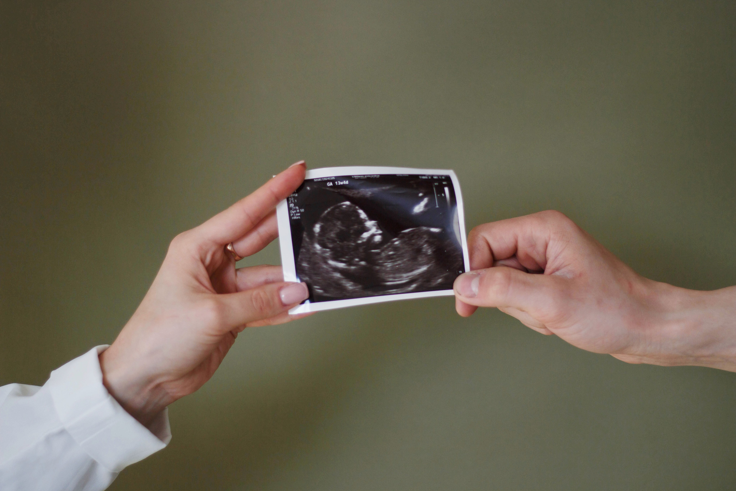 ARTEM & NASTYA. Бережно сохраняю ваши чувства и истории на своих фотографиях