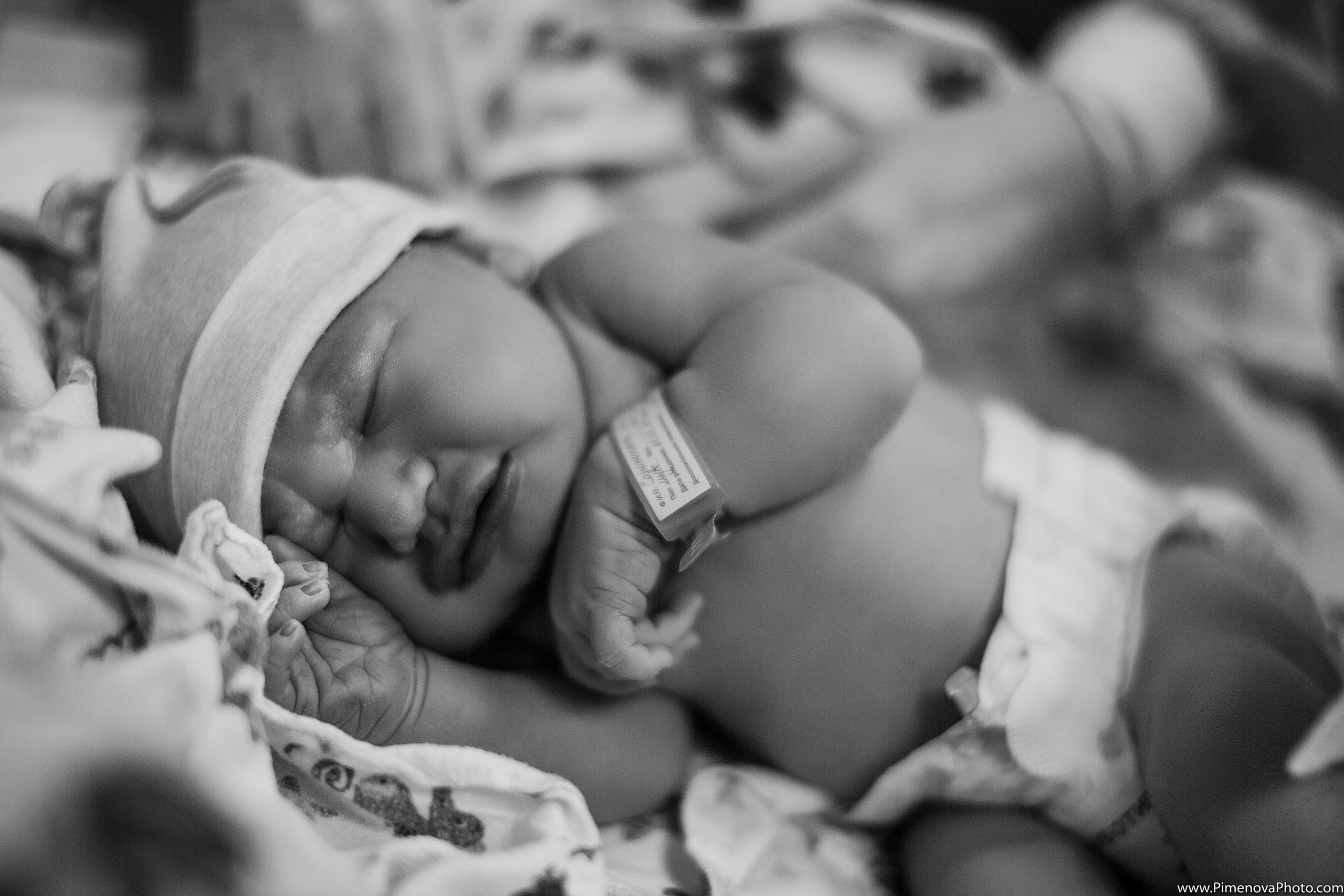 Плановое Кесарево Сечение. Семейный и детский фотограф в Петрозаводске