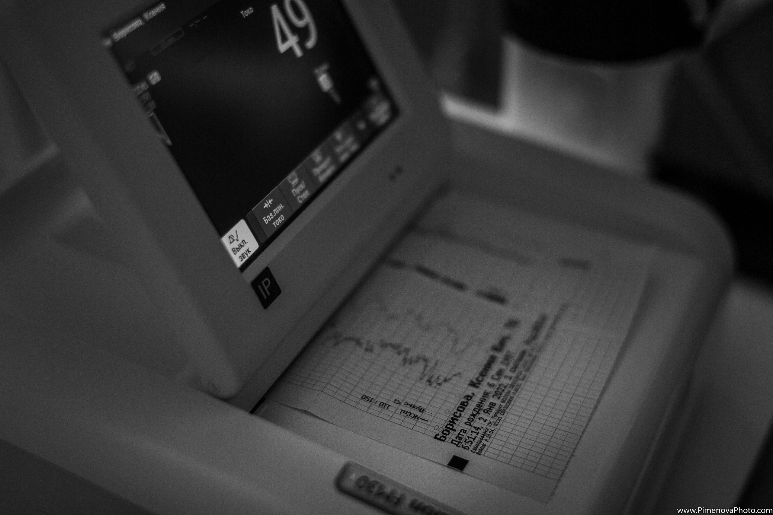 Партнёрские Роды. Семейный и детский фотограф в Петрозаводске