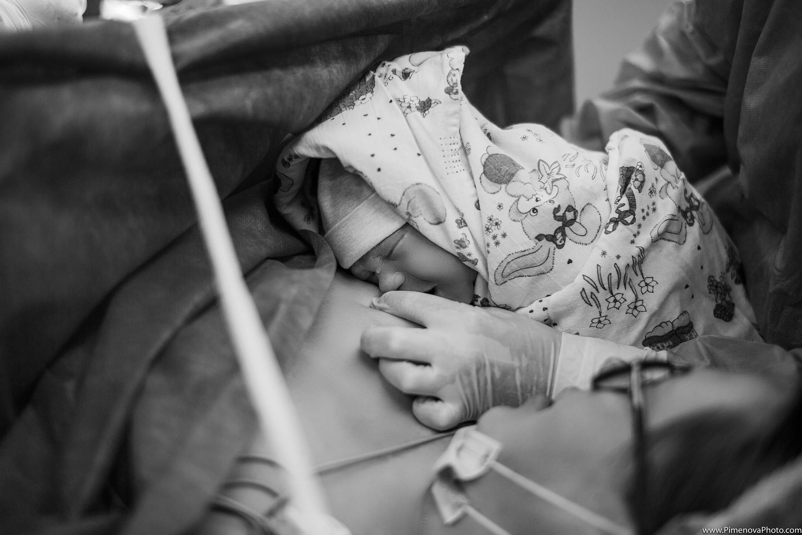 Плановое Кесарево Сечение. Семейный и детский фотограф в Петрозаводске