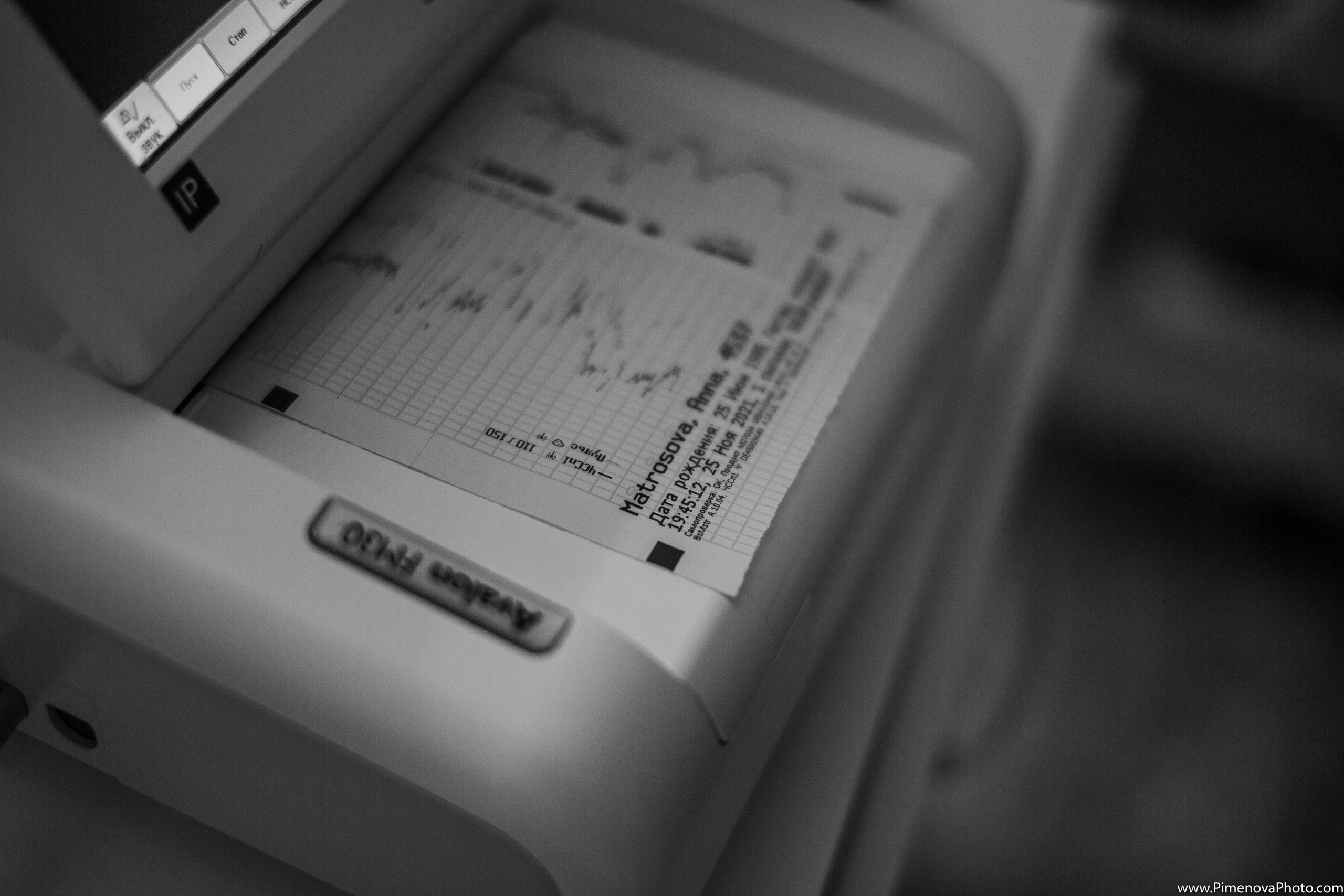 Экстренное Кесарево Сечение. Семейный и детский фотограф в Петрозаводске