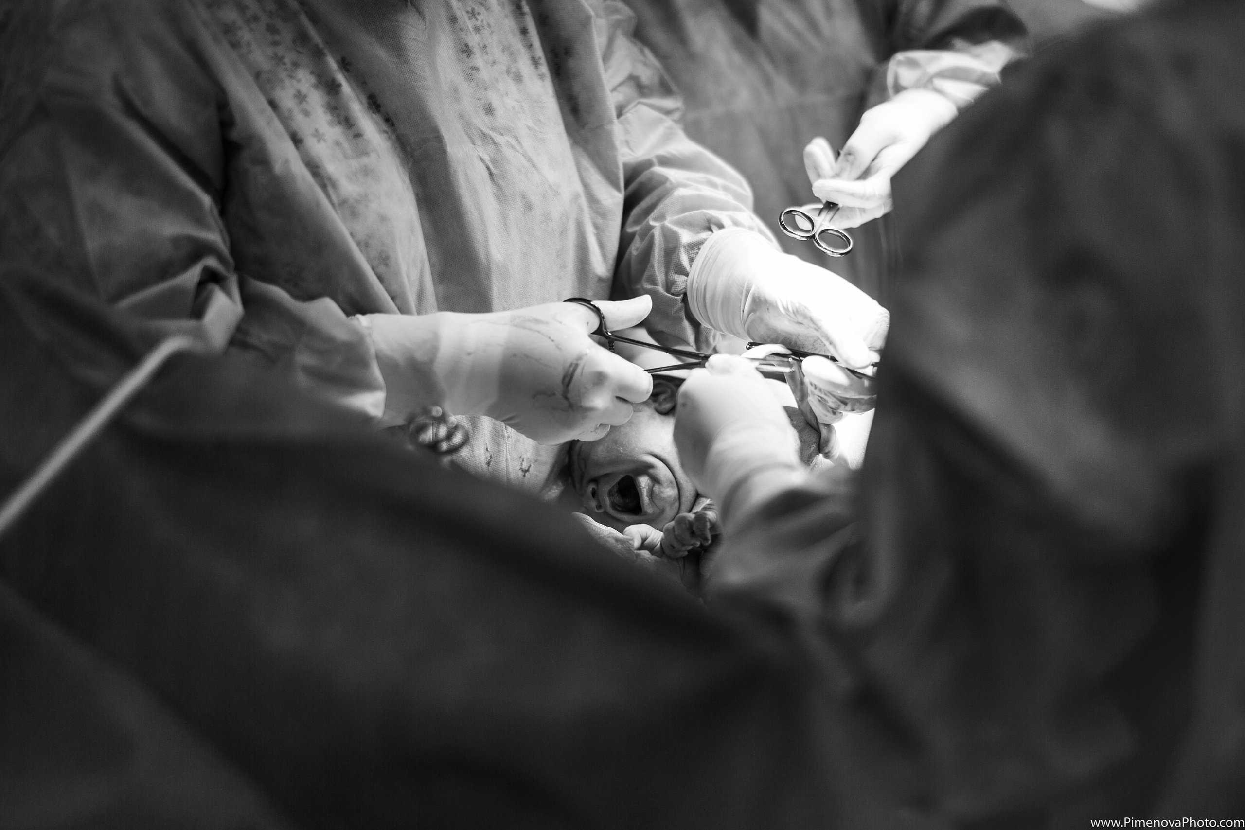 Экстренное Кесарево Сечение. Семейный и детский фотограф в Петрозаводске