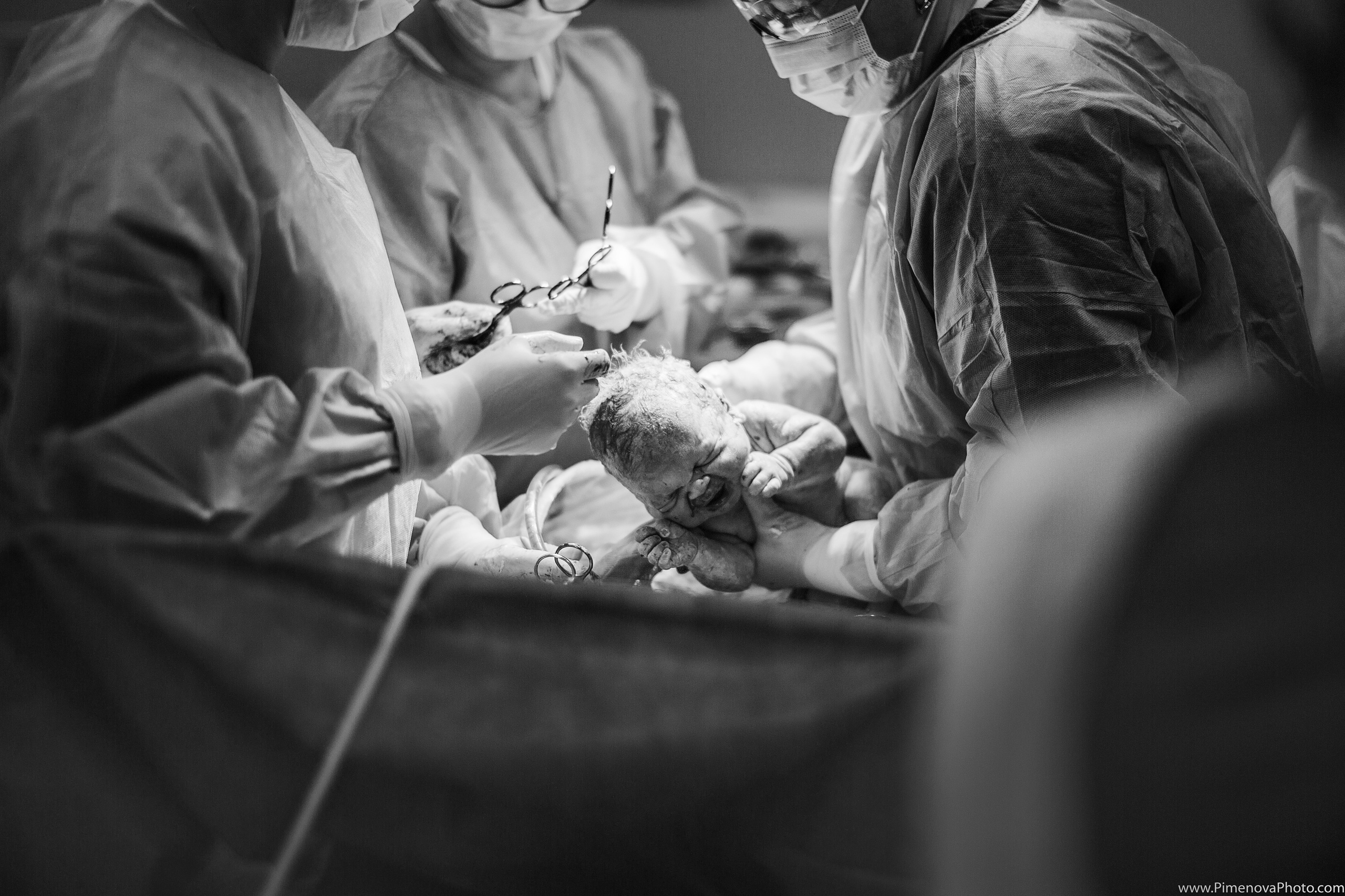 Экстренное Кесарево Сечение. Семейный и детский фотограф в Петрозаводске