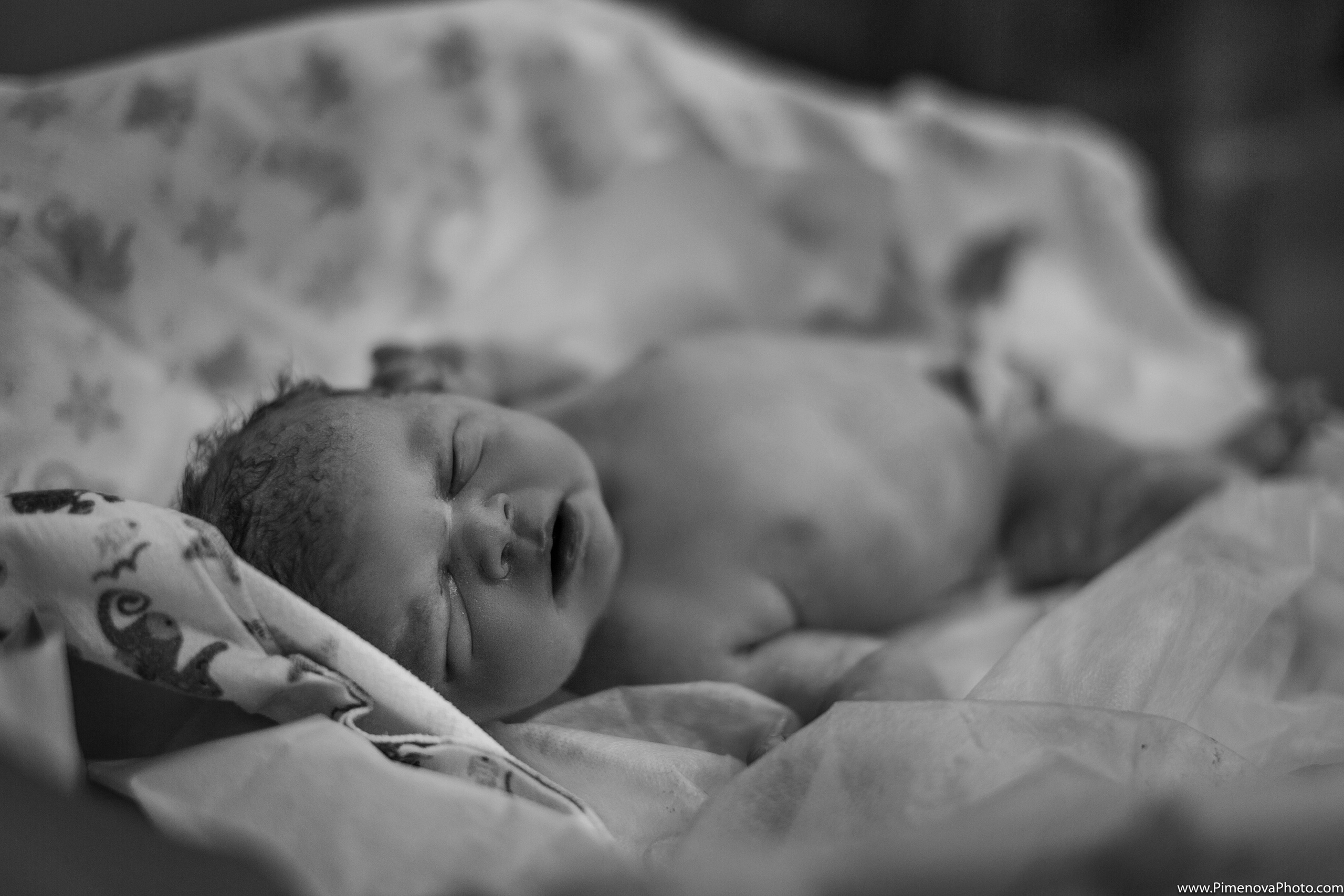 Экстренное Кесарево Сечение. Семейный и детский фотограф в Петрозаводске