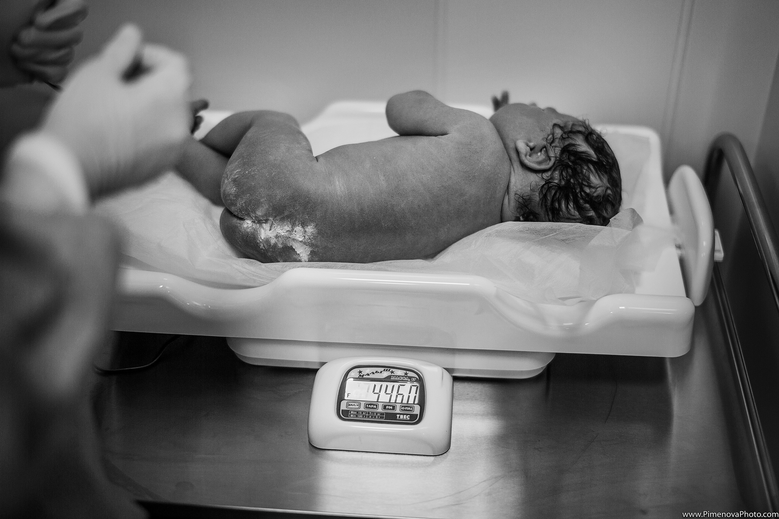 Плановое Кесарево Сечение. Семейный и детский фотограф в Петрозаводске