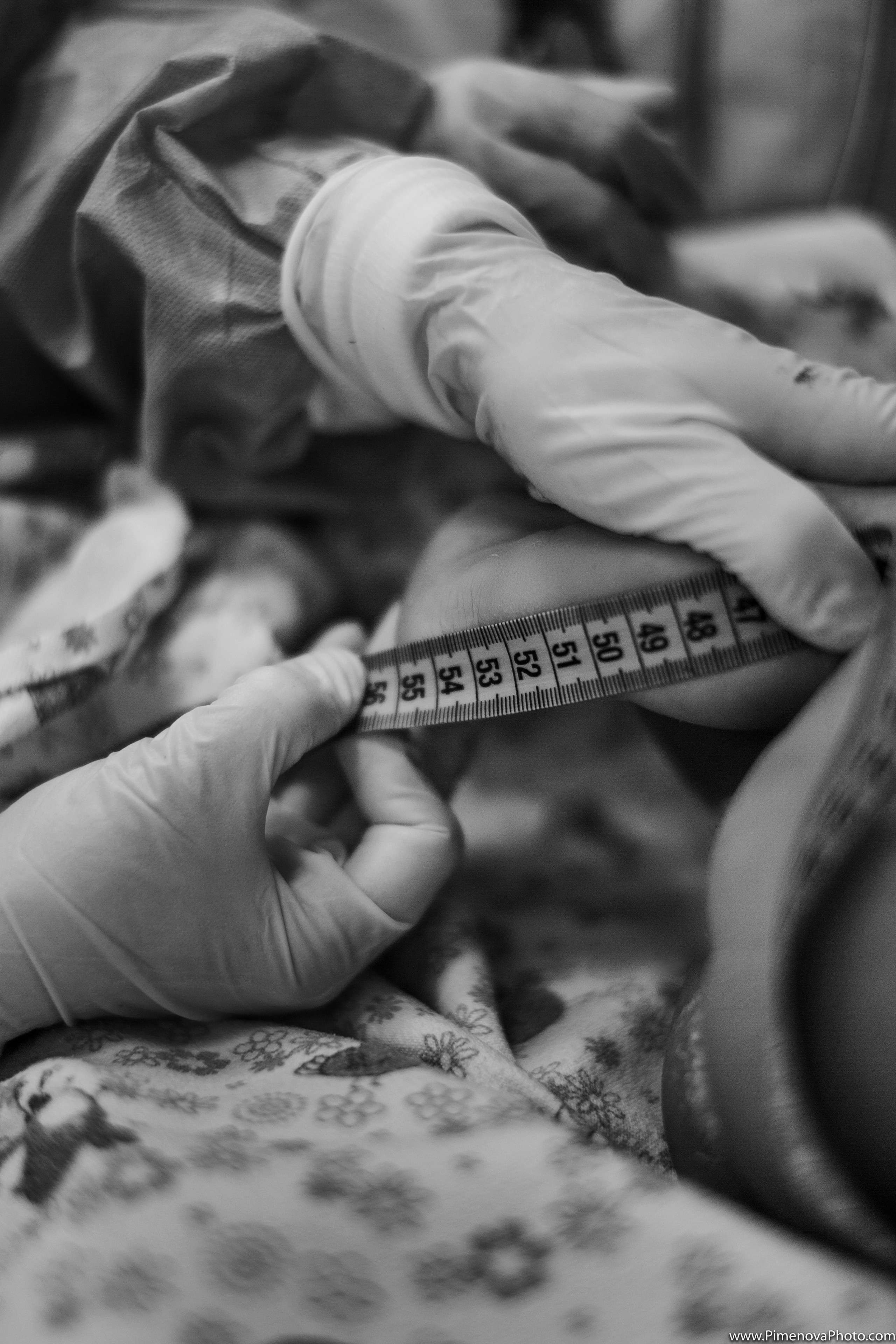 Экстренное Кесарево Сечение. Семейный и детский фотограф в Петрозаводске