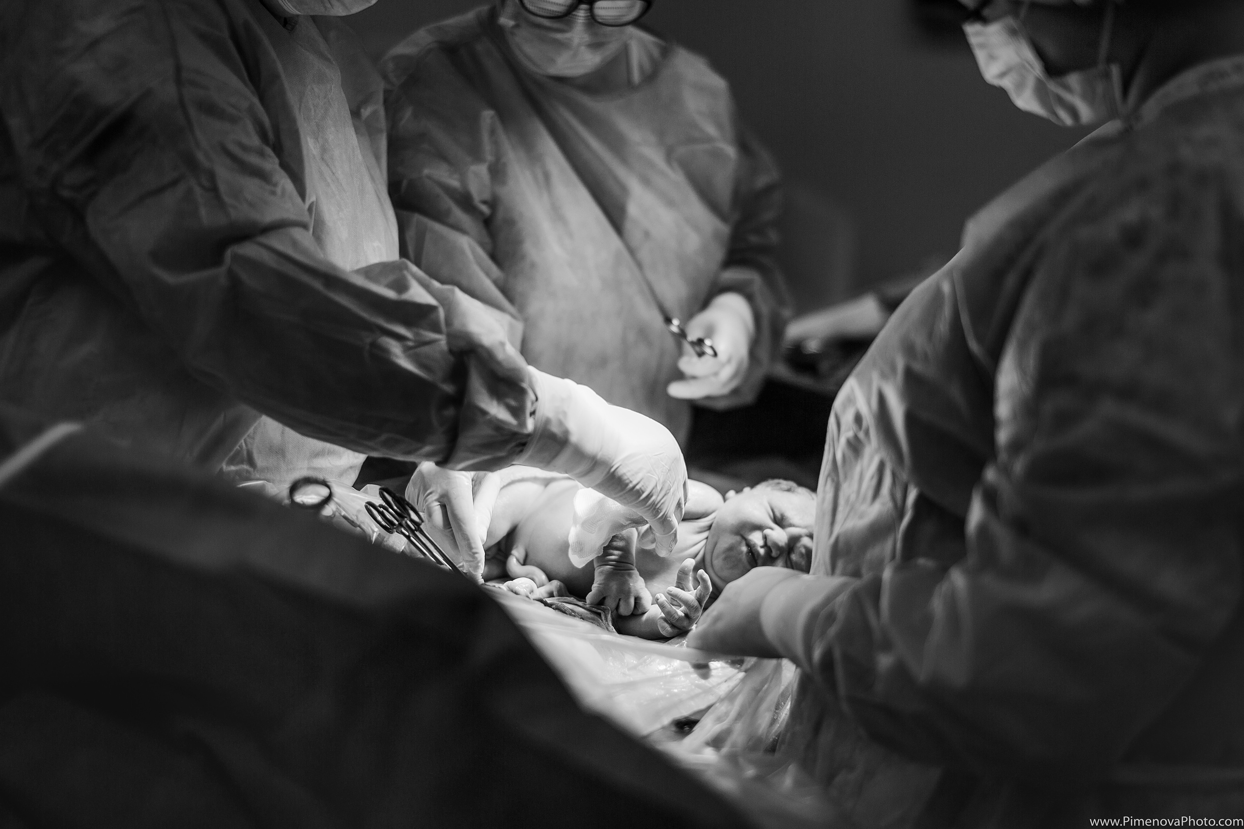 Плановое Кесарево Сечение. Семейный и детский фотограф в Петрозаводске