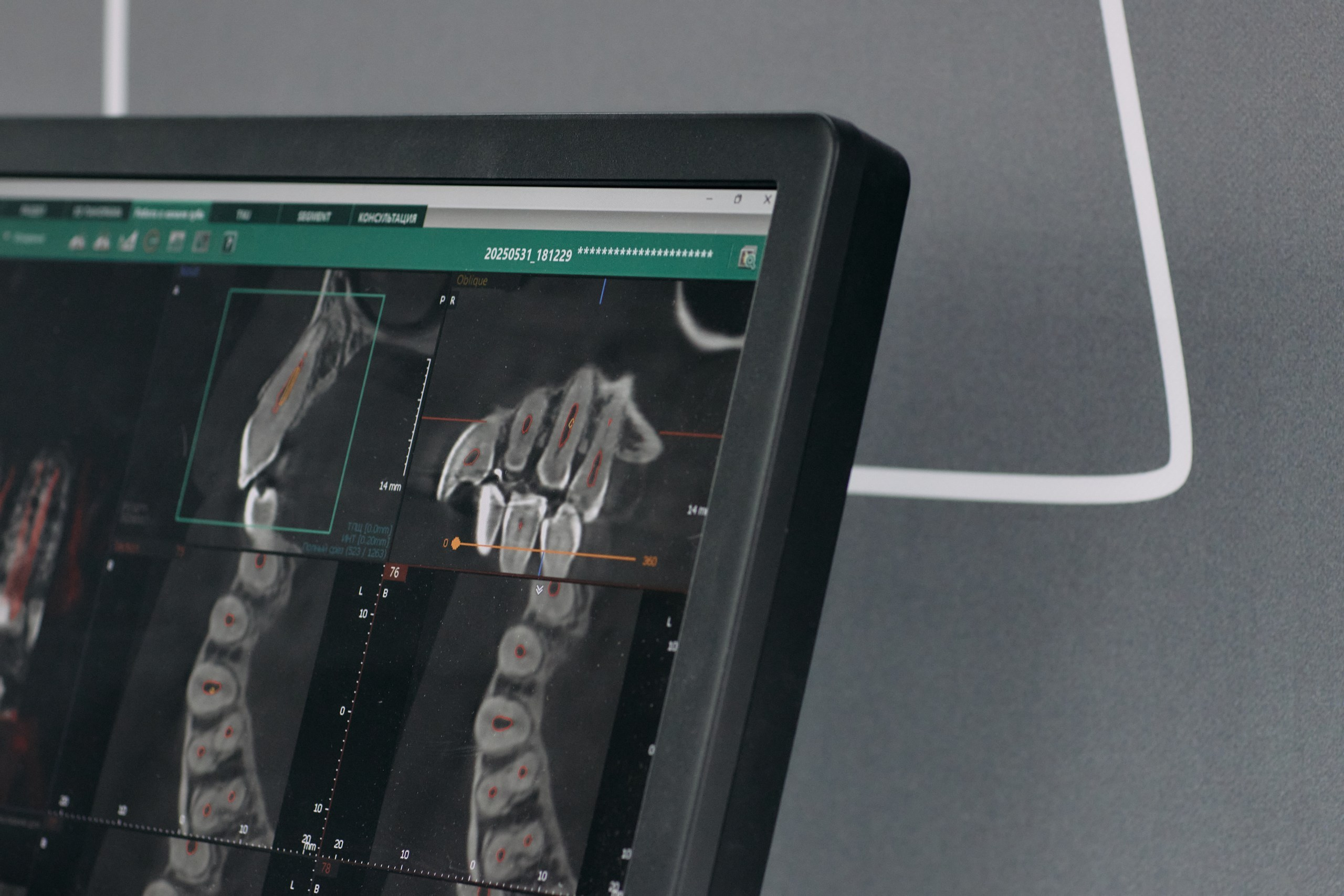 Дентал Салон 2026: Vatech. Свадебный и репортажный фотограф Дмитрий Кононенко