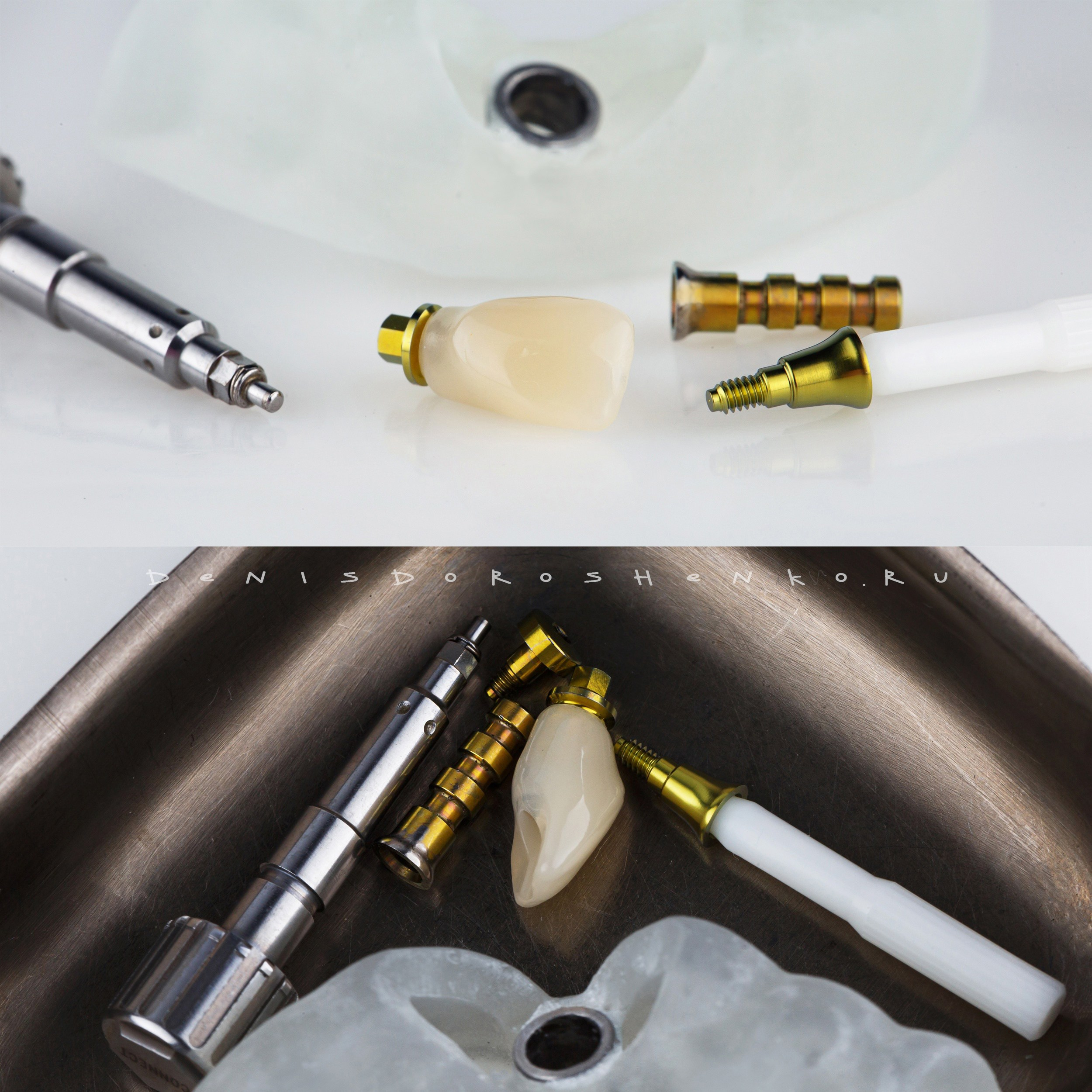 Хирургия. Дентал фотограф — видеограф Денис Дорошенко