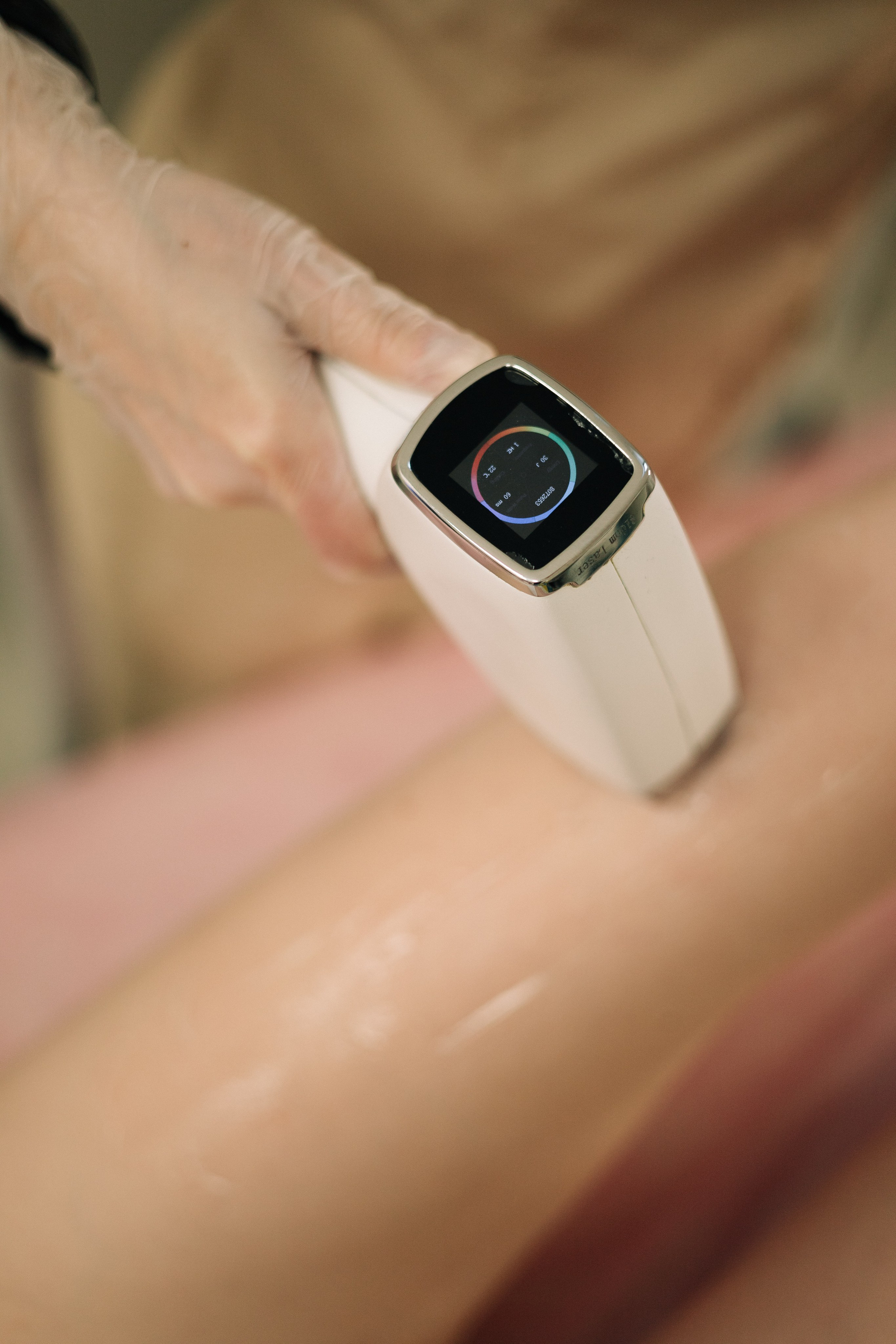 Студия лазерной эпиляции