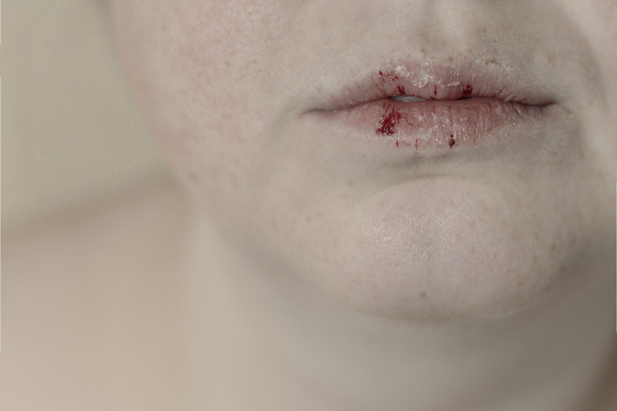 → Crystal formation. Darya Pyanzina (d.snapshots)