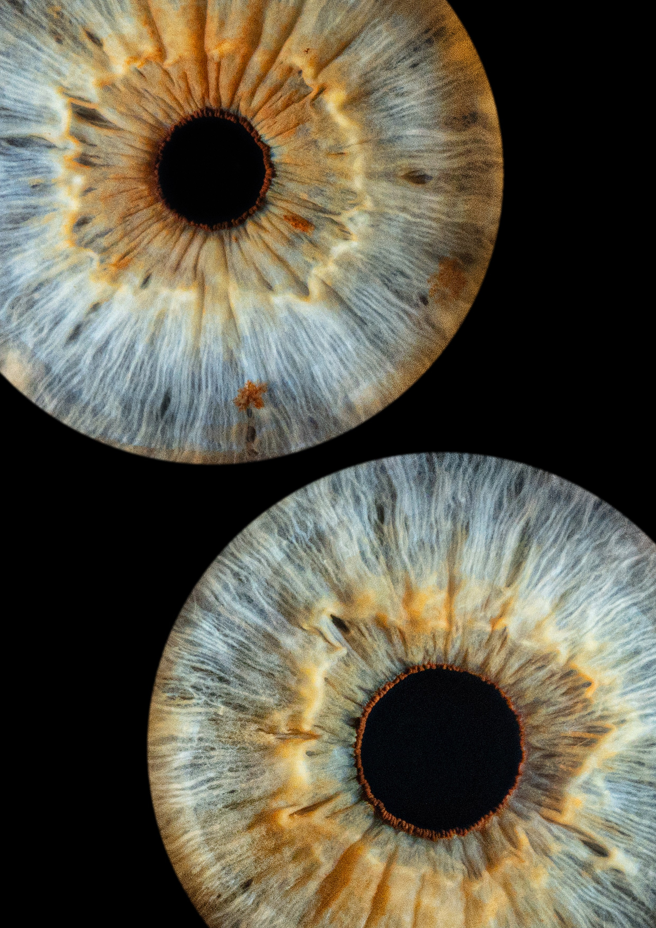 Примеры работ. Мой глаз