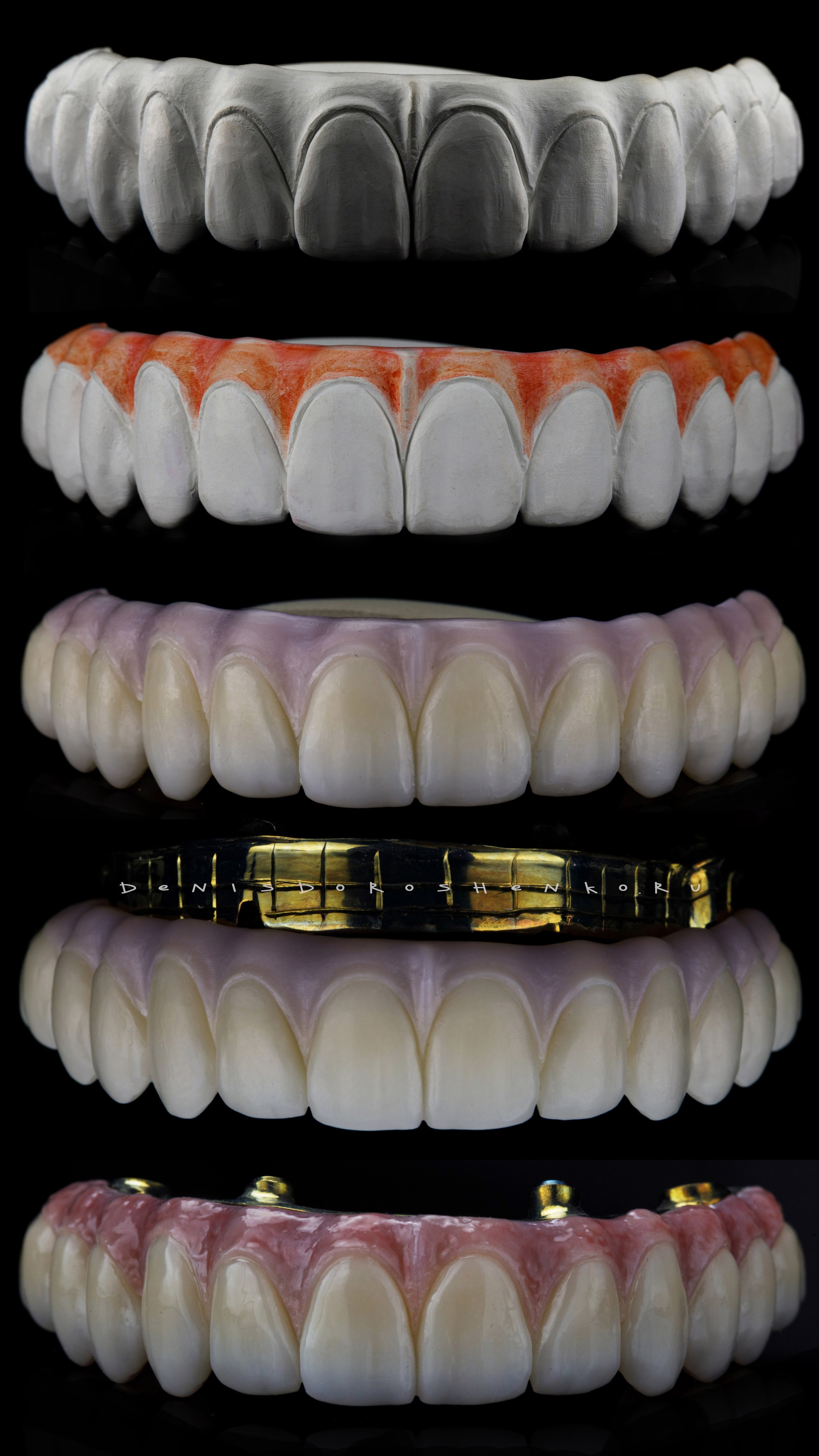 Предметная съёмка. Дентал фотограф — видеограф Денис Дорошенко