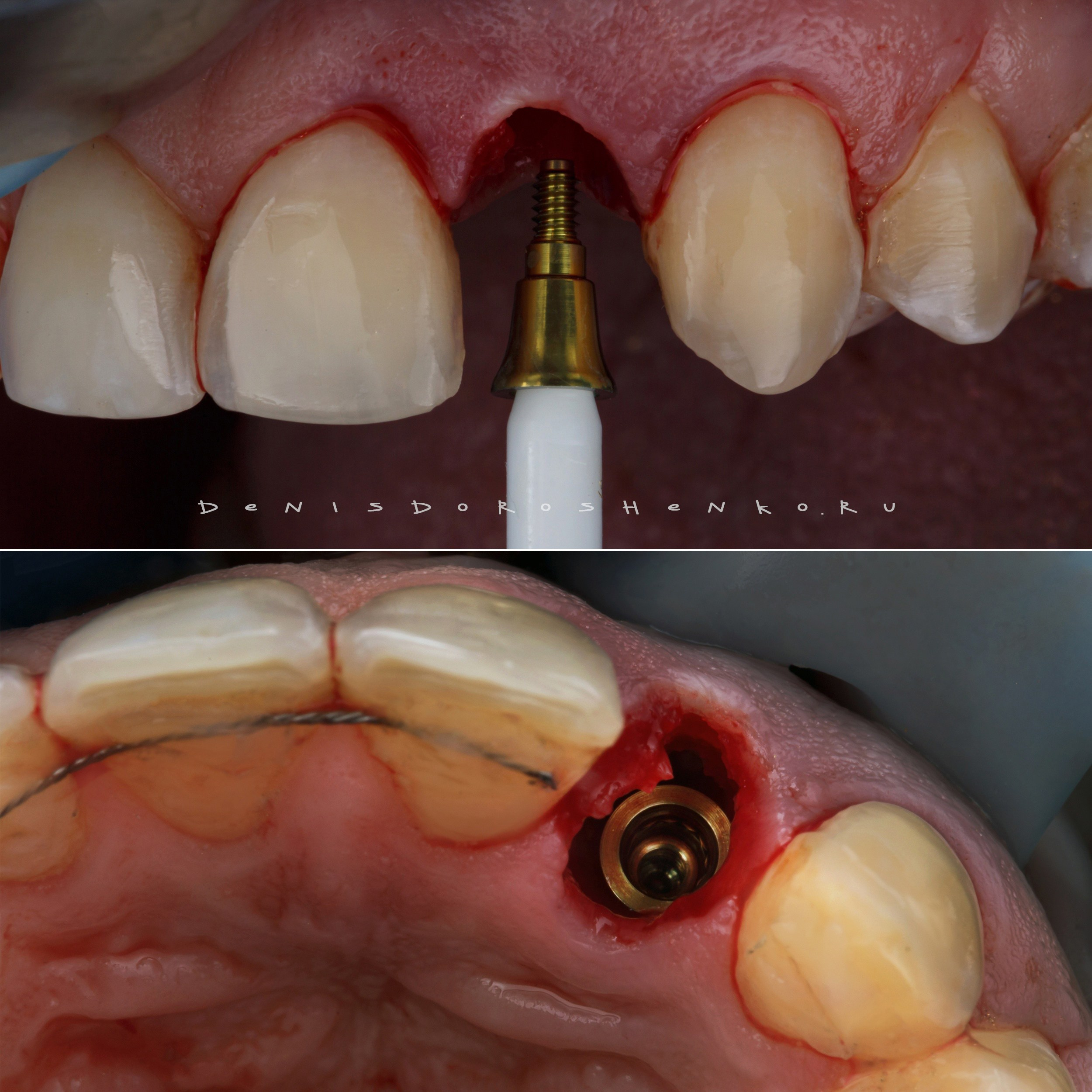 Хирургия. Дентал фотограф — видеограф Денис Дорошенко