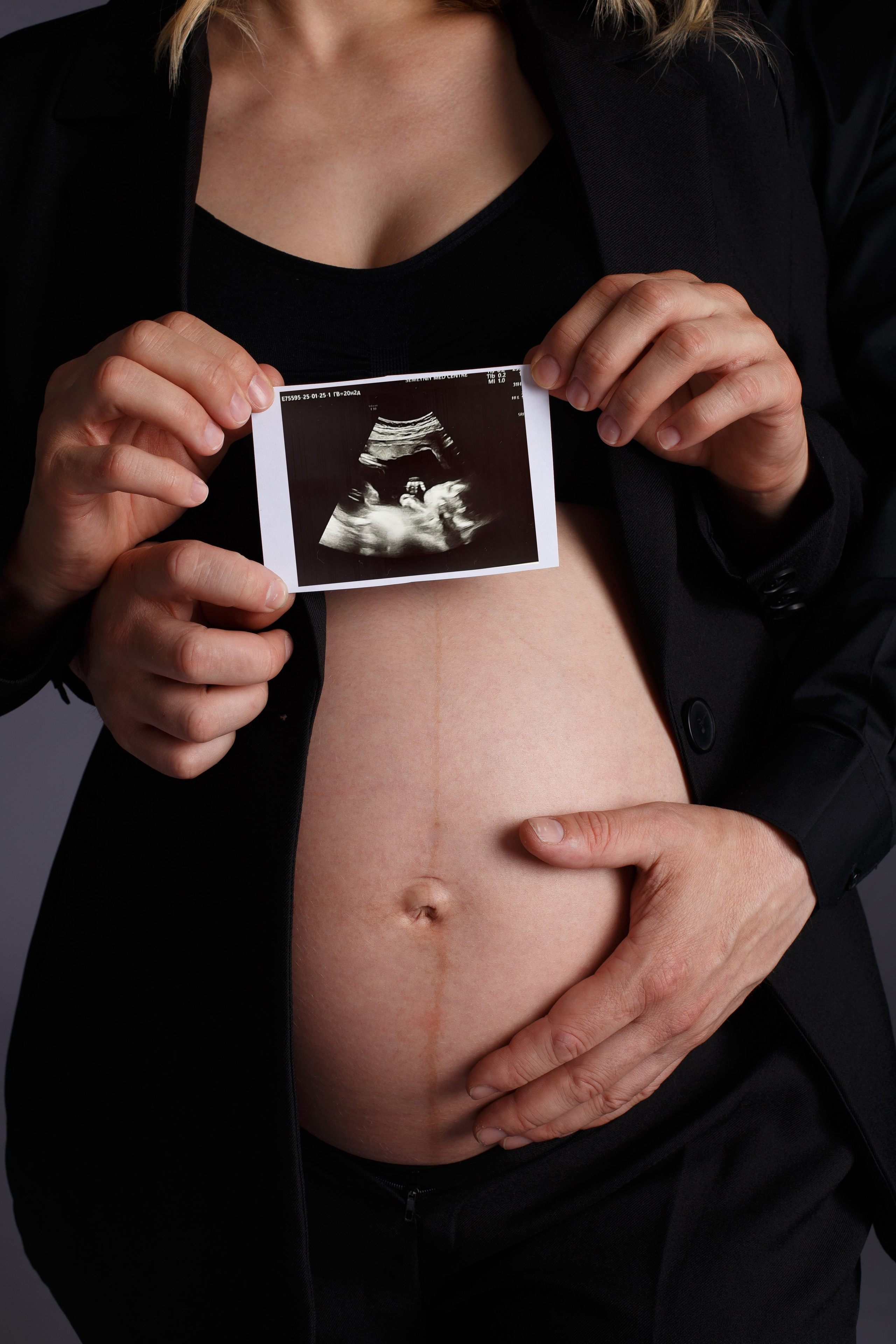 Фотосессия беременности в Железнодорожном и Балашихе