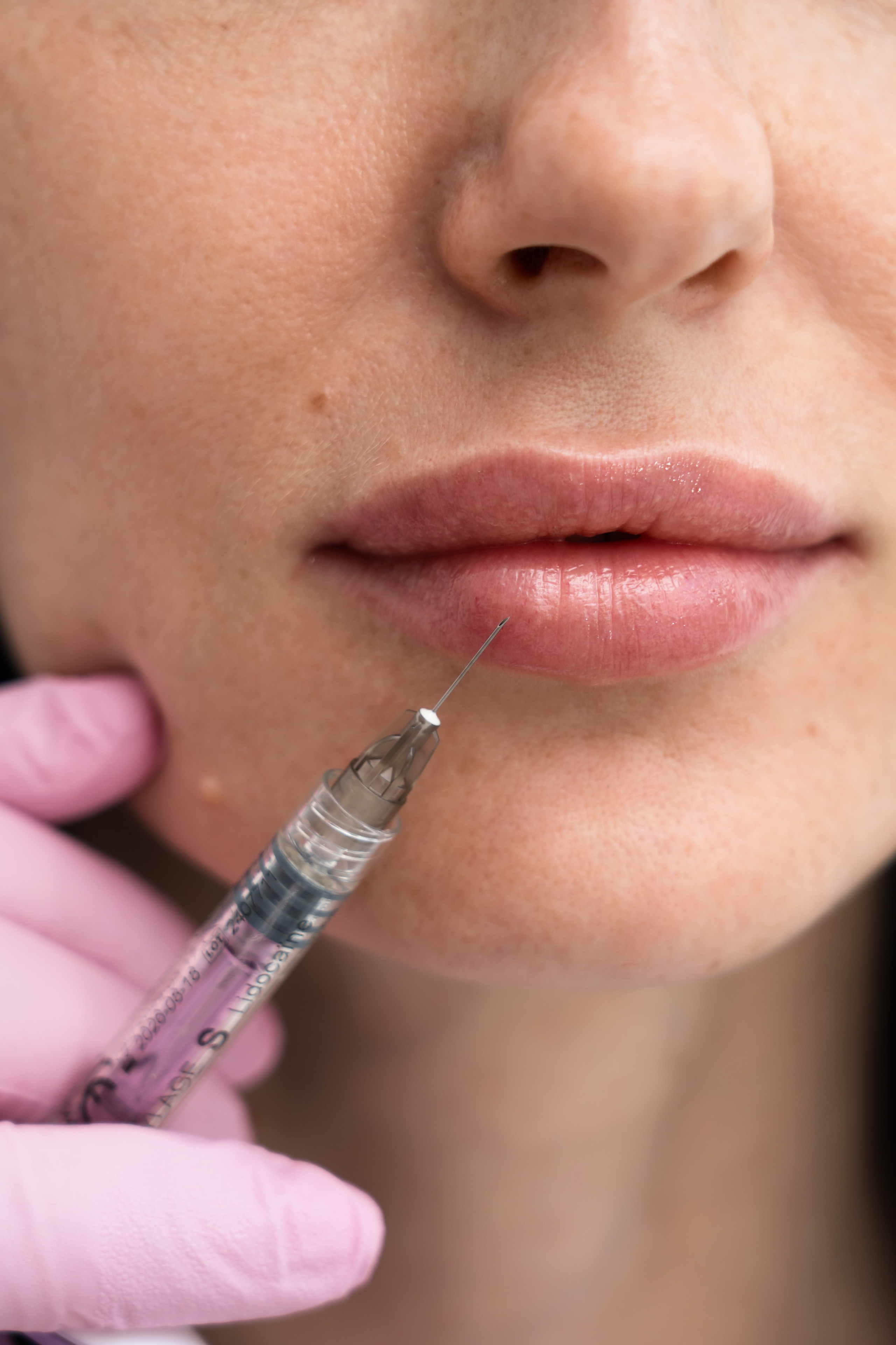 Фотосъемка контента для клиники косметологии Барнаул