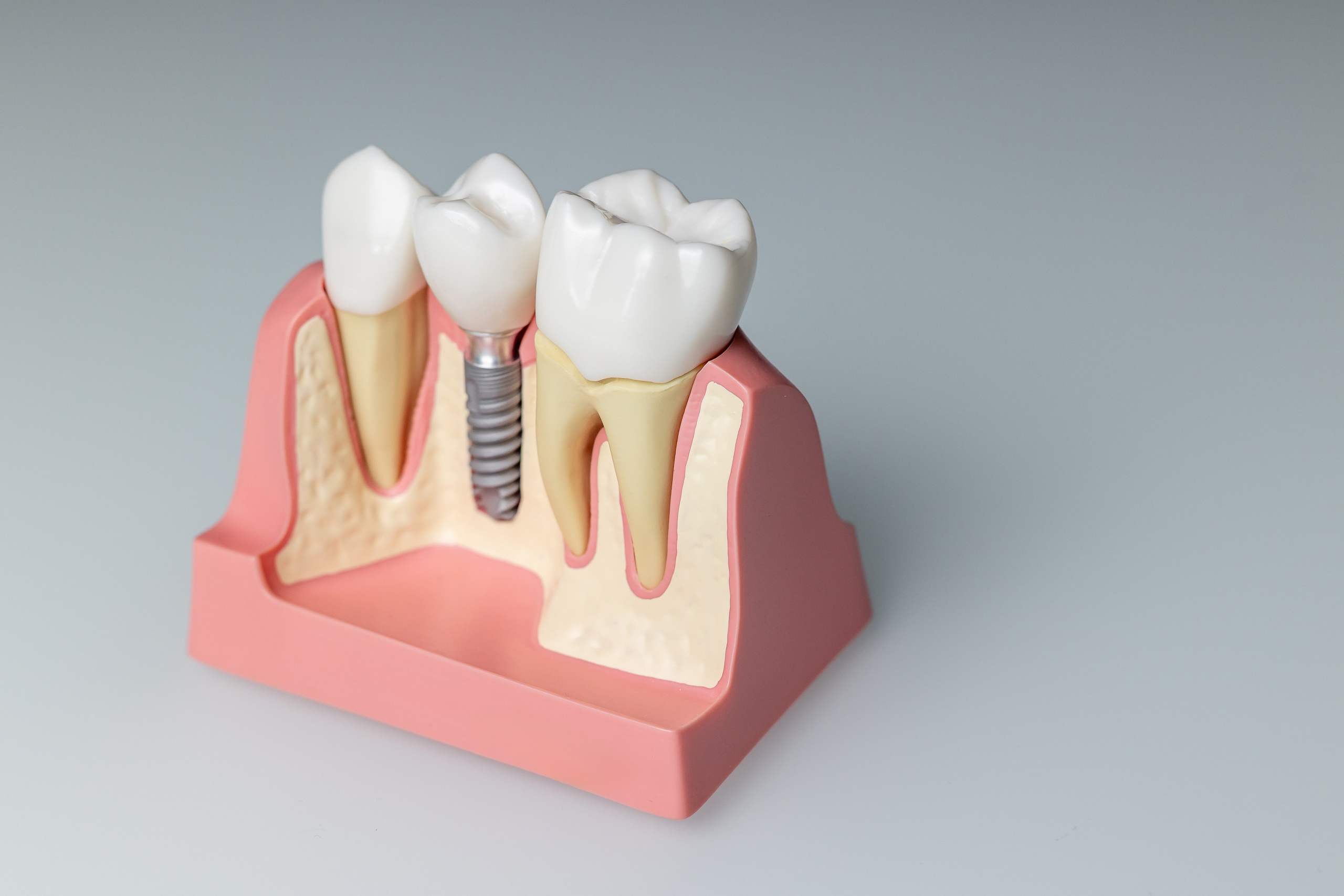 Съемка для клиник. Профессиональный фотограф в Санкт-Петербурге Алена Яшина