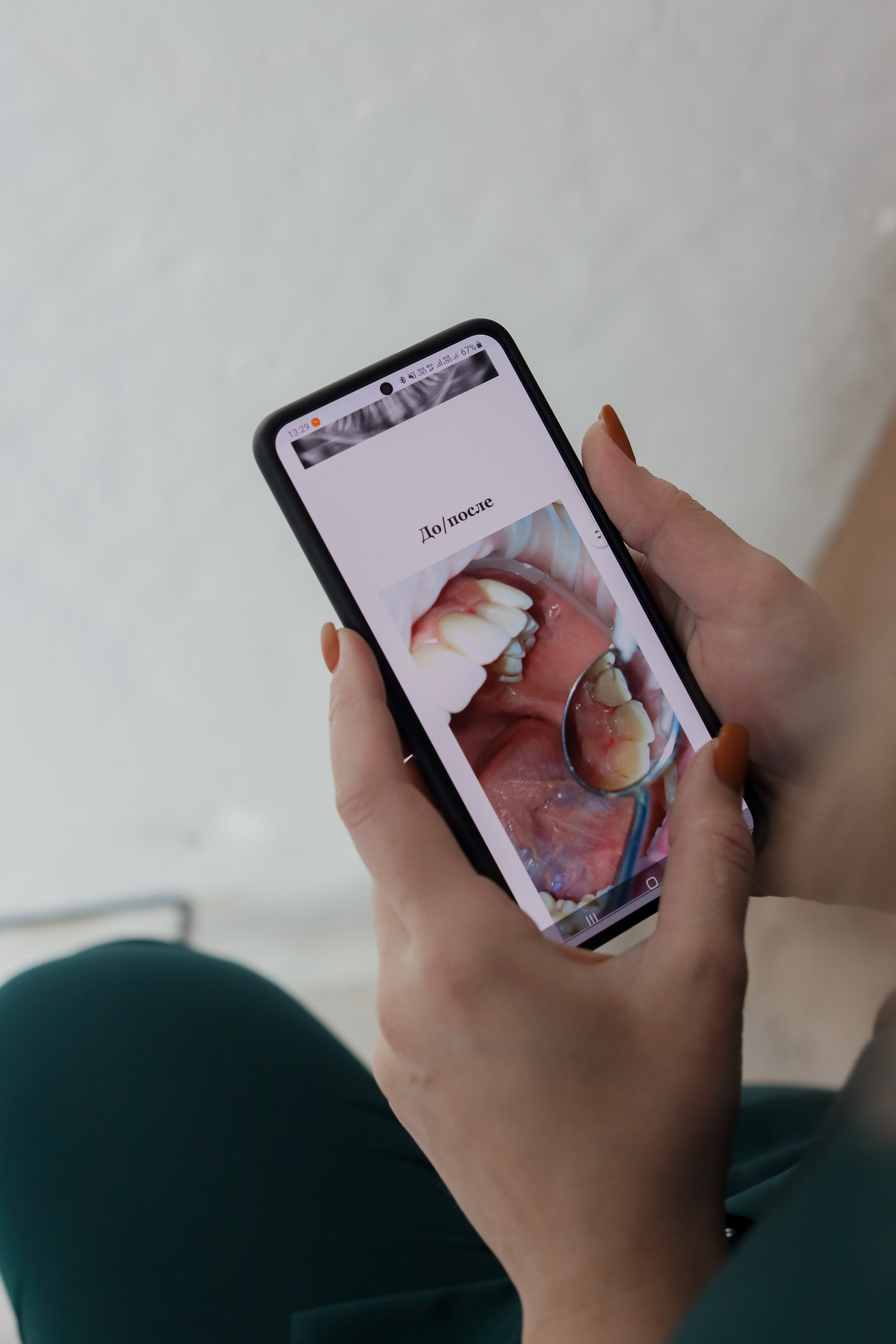 Стоматолог Марианна. Фотограф Анастасия Пинчук