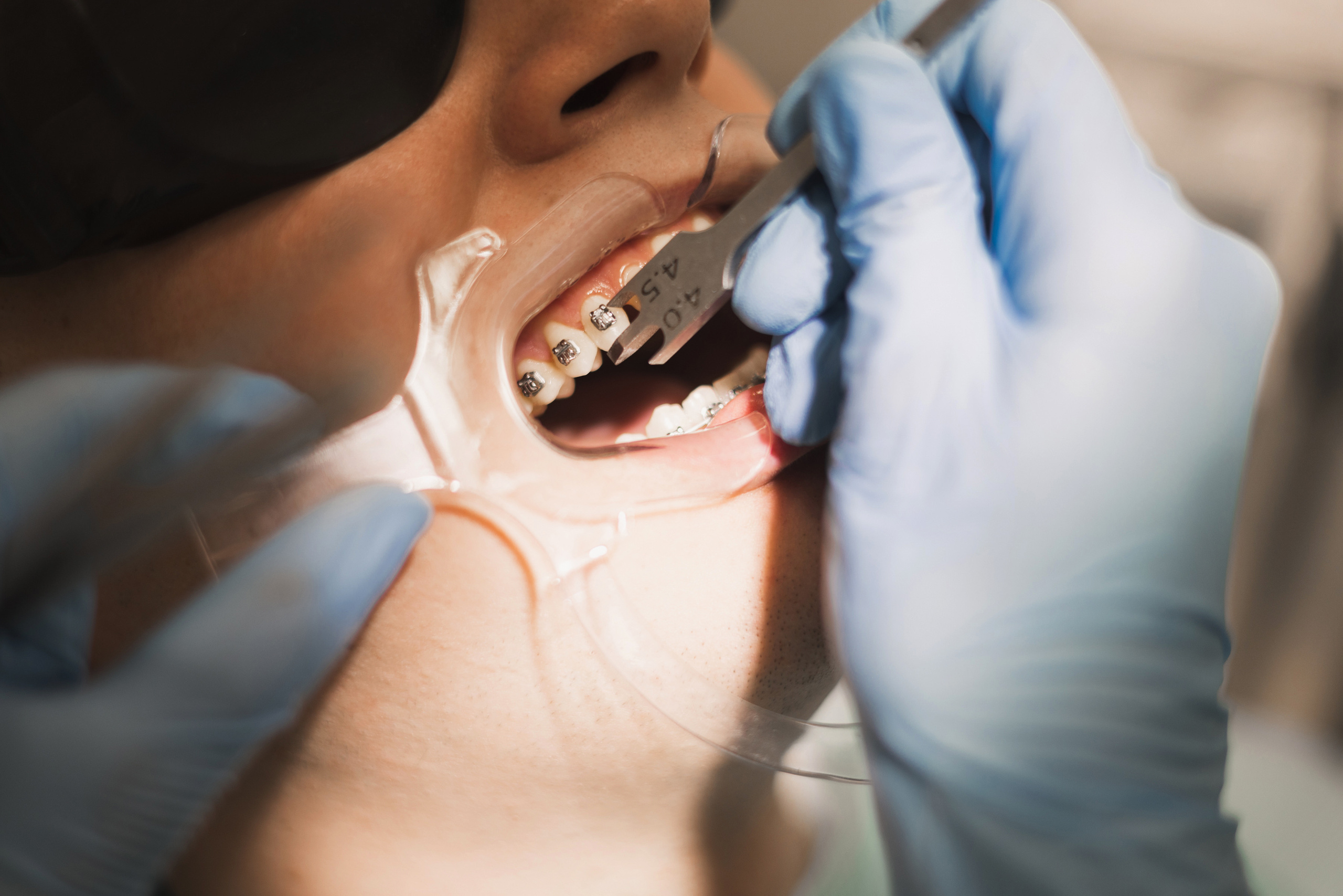 Стоматолог-ортодонт. Портретный фотограф СПб, женский фотограф, минимализм и эстетика