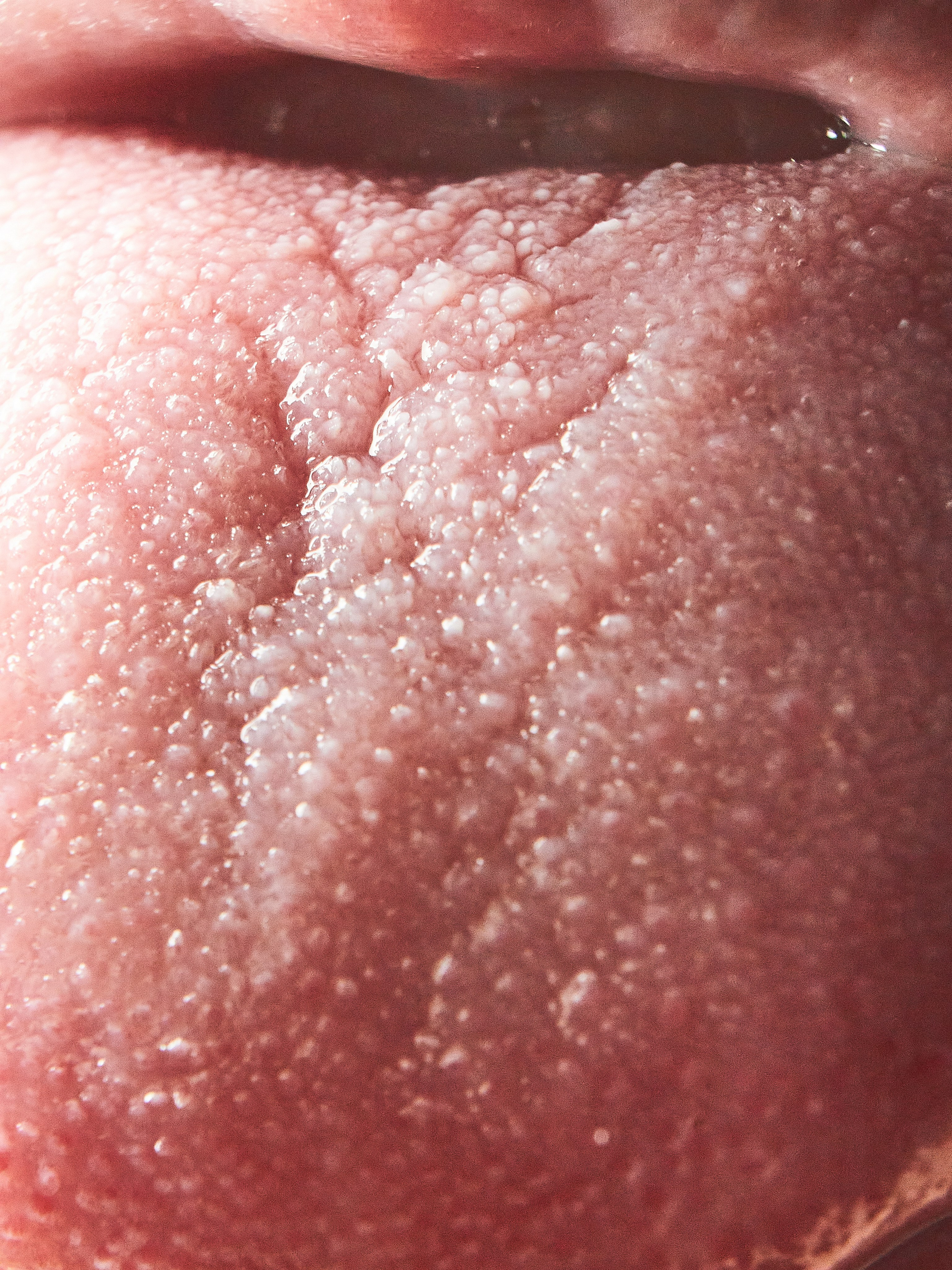 MACRO | skin textures. Фотограф Валерий Федяев | vallerzu