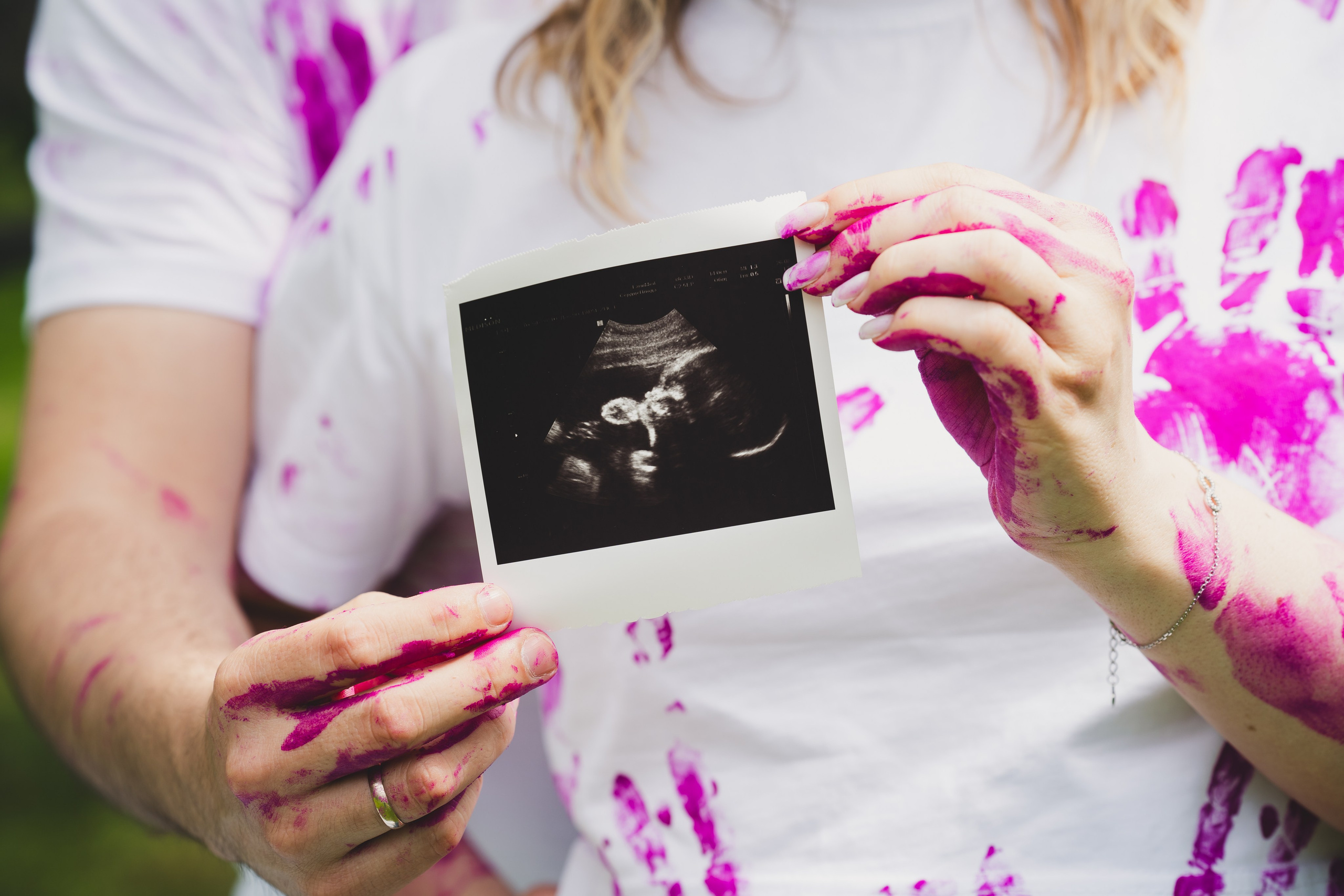 Гендер-пати на природе. Репортажный фотограф в Москве Легкая Софья