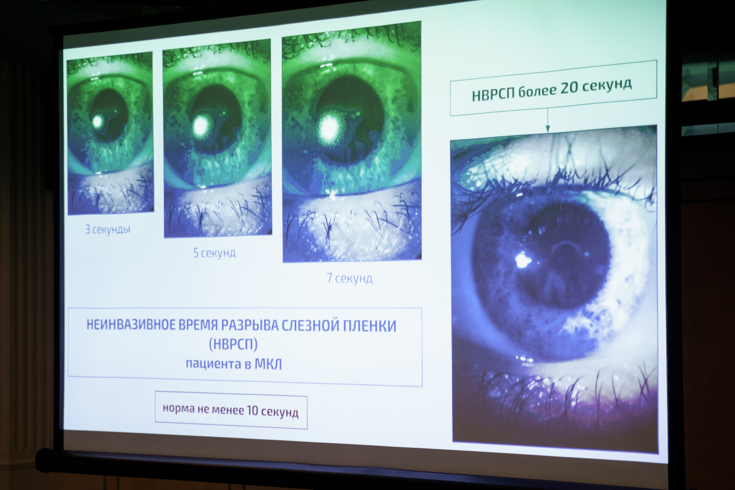 Конференция Cooper Vision в Отеле Амбасадор 28 октября 2023. Свадебный и семейный фотограф в Санкт-Петербурге Дмитрий Панин