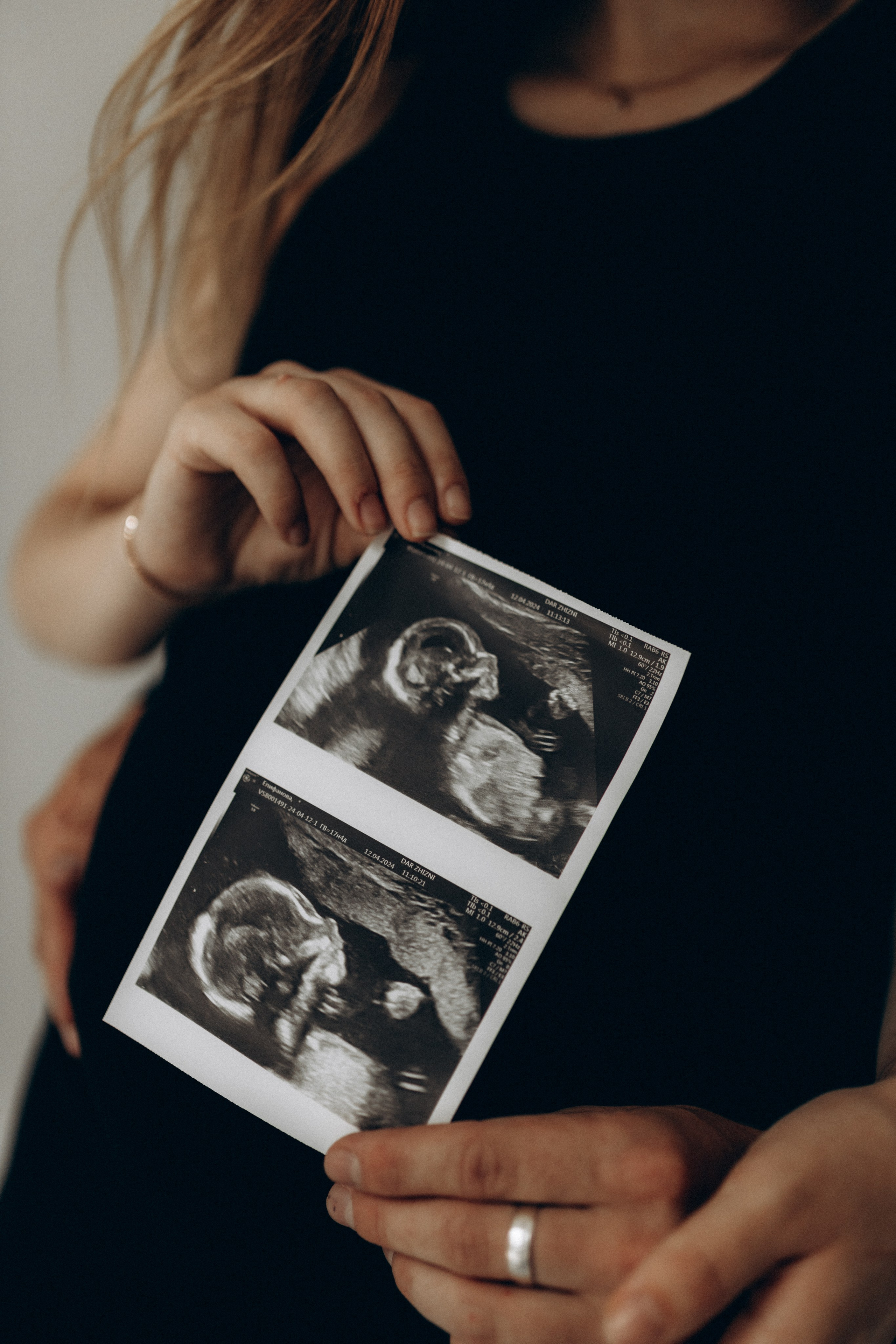 Вероника & Стас. Беременность. Фотограф НОГИНСК, Москва, Анастасия Белая