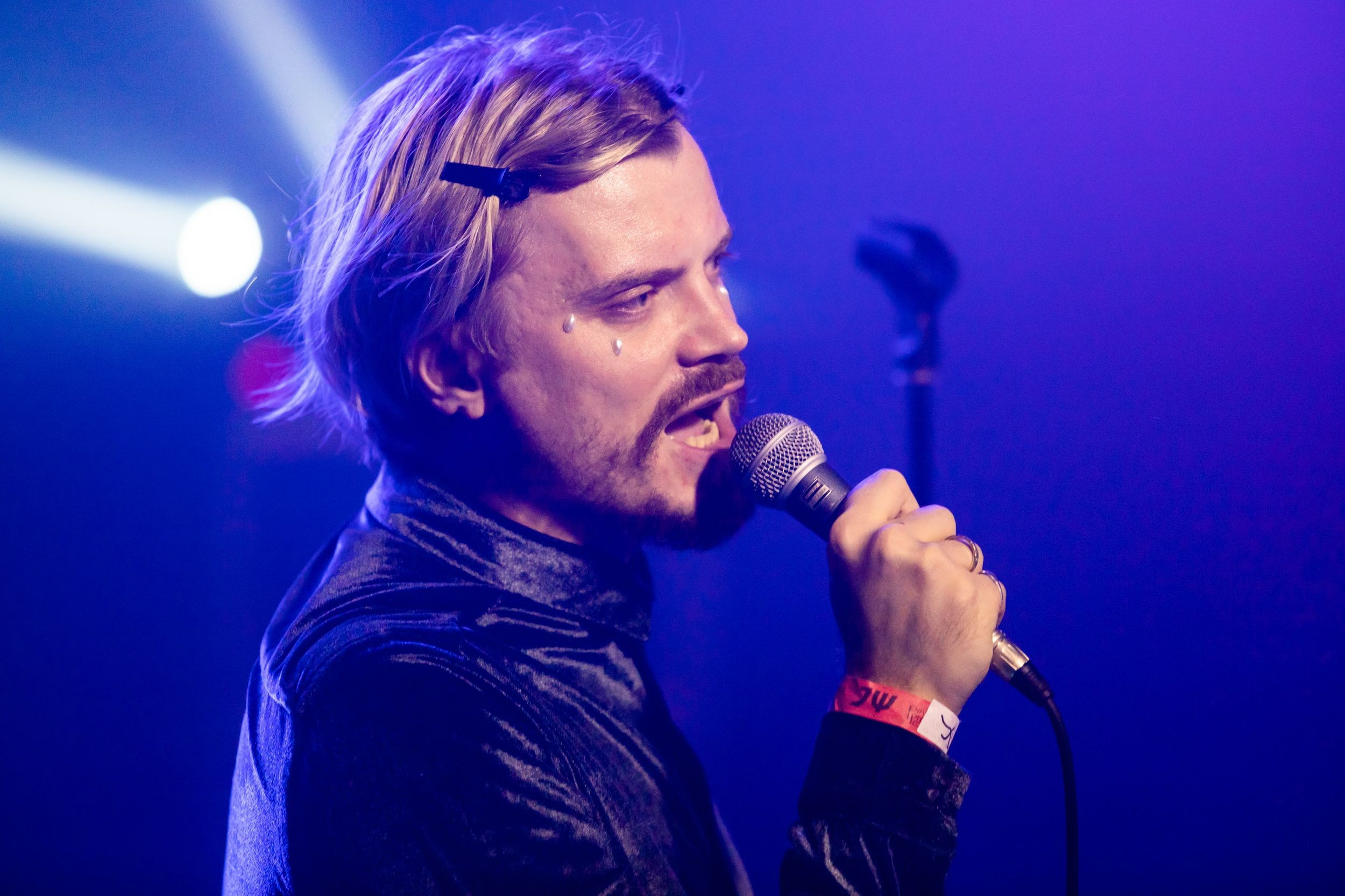 Электрофорез. Репортажный фотограф Алексей Пирязев