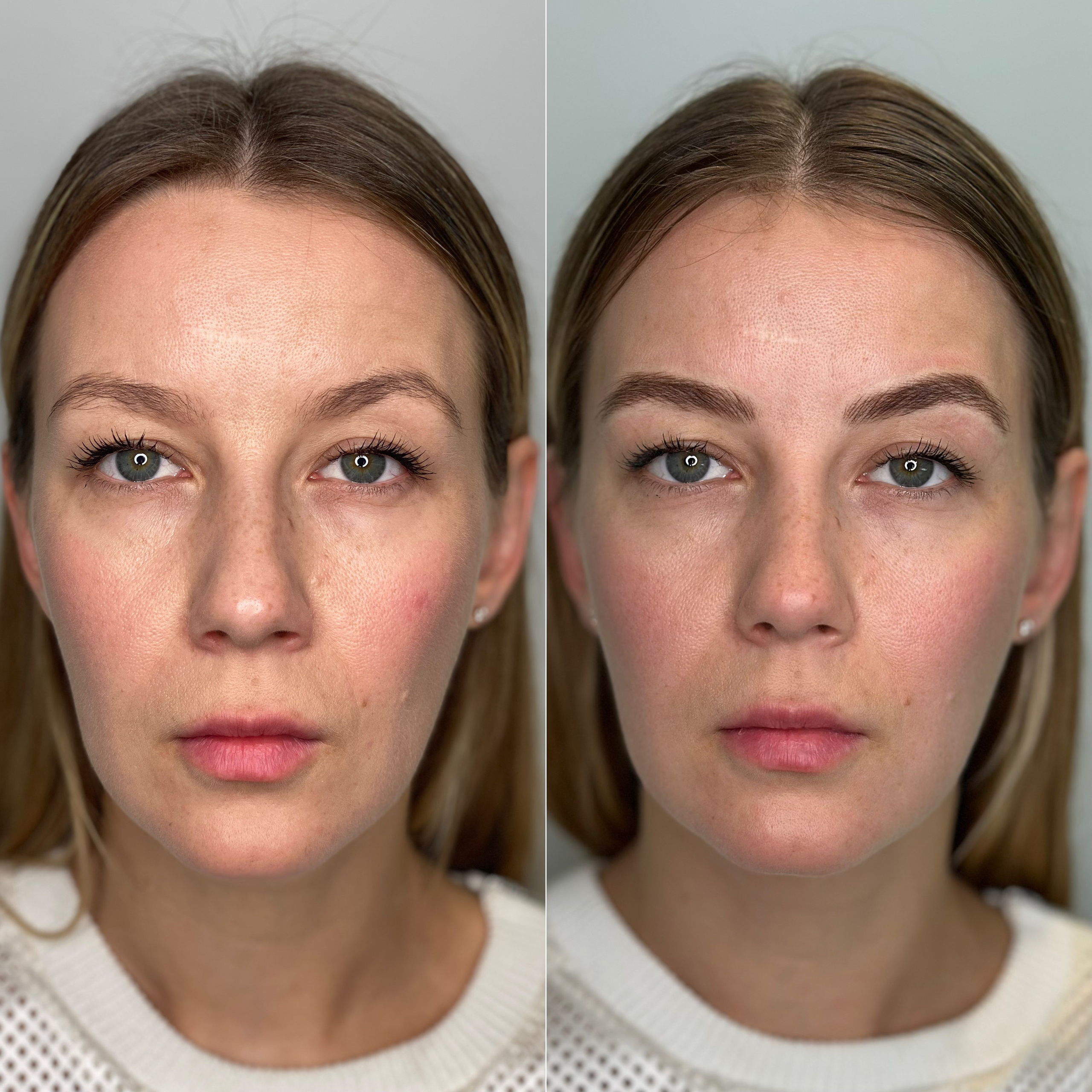 Олеся. Студия перманентного макияжа, косметологии и массажа SYMMETRY в Москве, м. Киевская