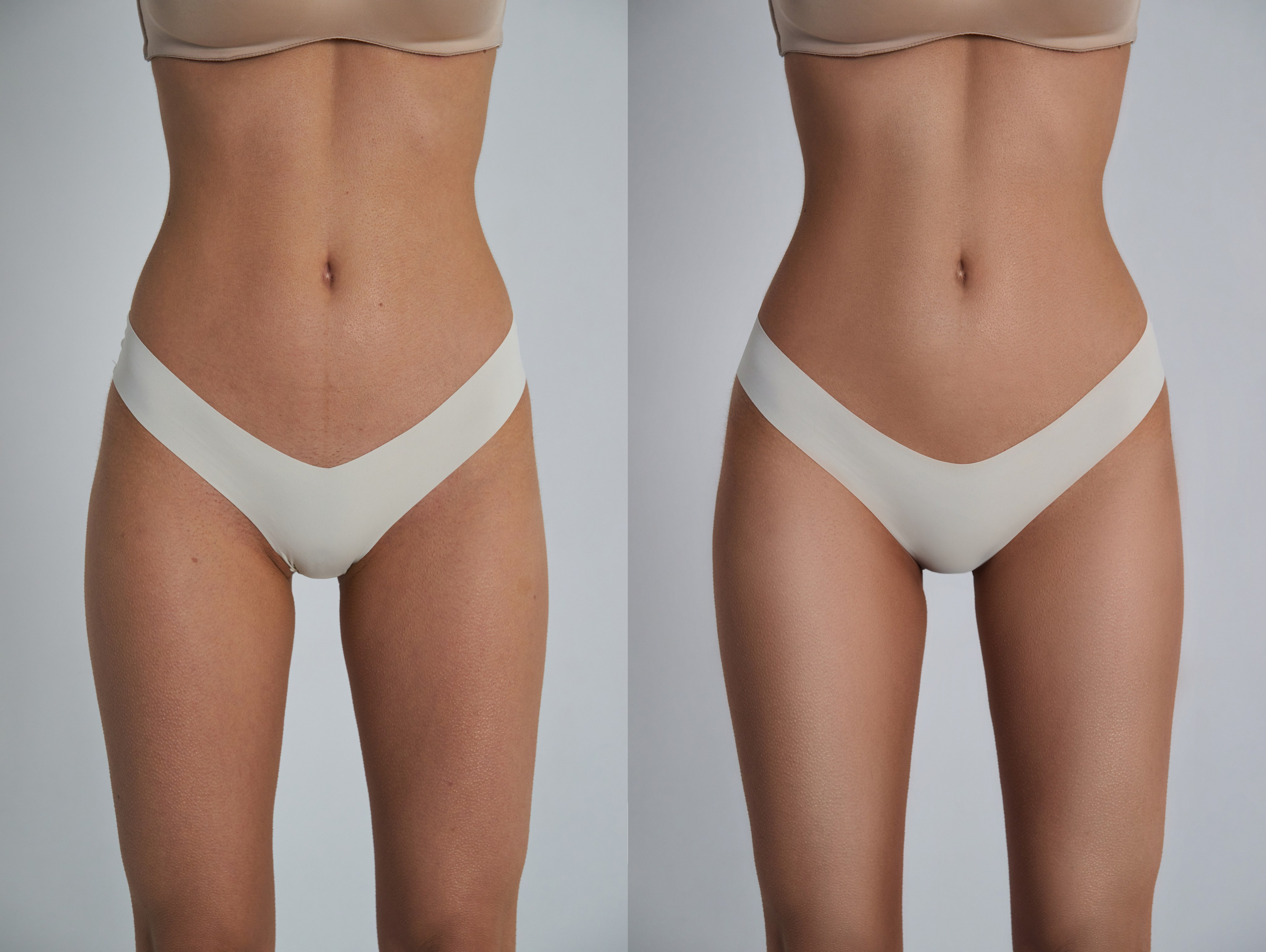 Деликатная обработка портретов для рекламы нижнего белья | Студия SVITHART