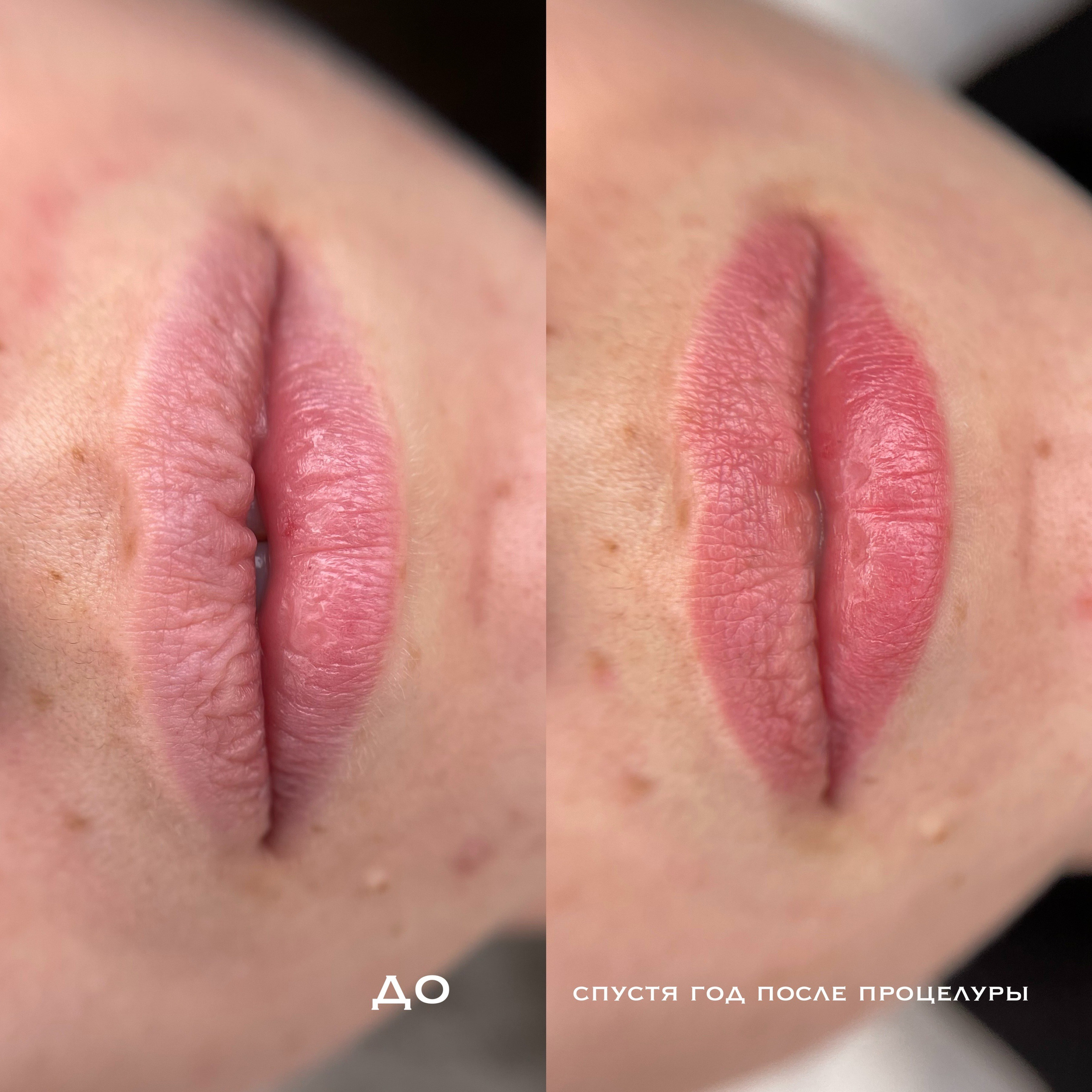ГУБЫ зажившие. Перманентный макияж и удаление старого татуажа в Ростове-на-Дону Дарья Исакова