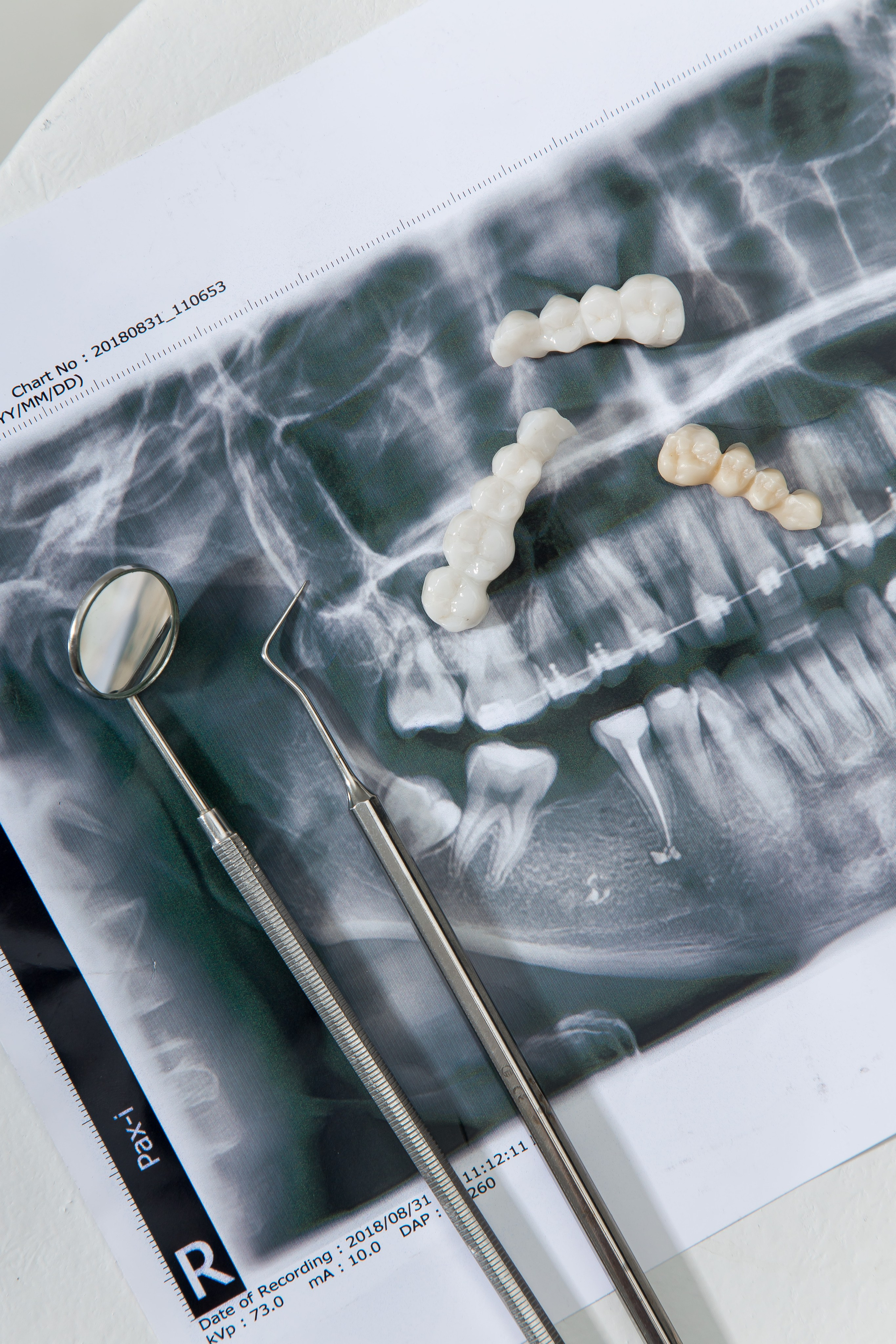 Clinic. Свадебный и студийный фотограф в Алматы Ильяс Кырбаев