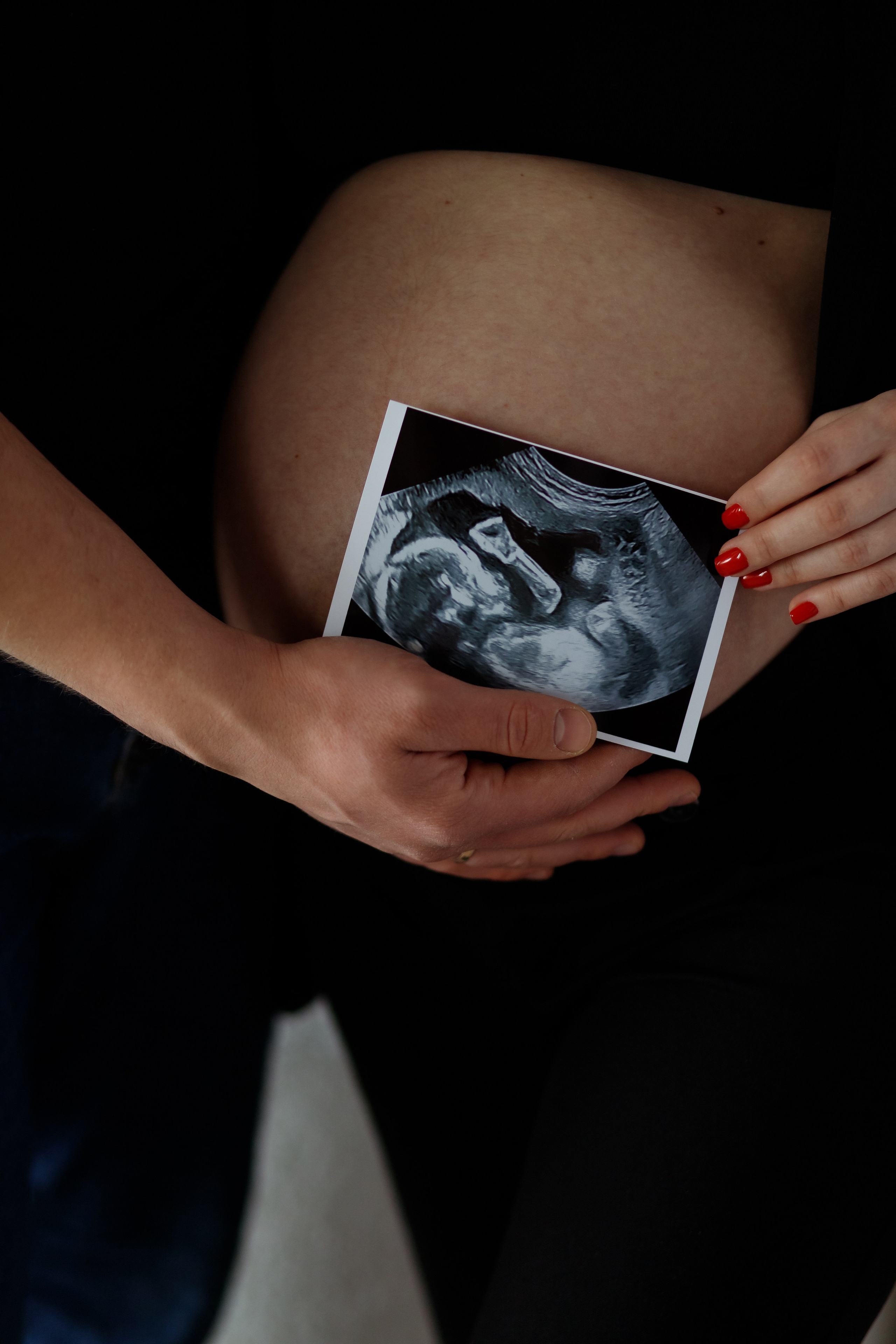 Фотосъемка беременности. Фотограф Карпачан Анастасия