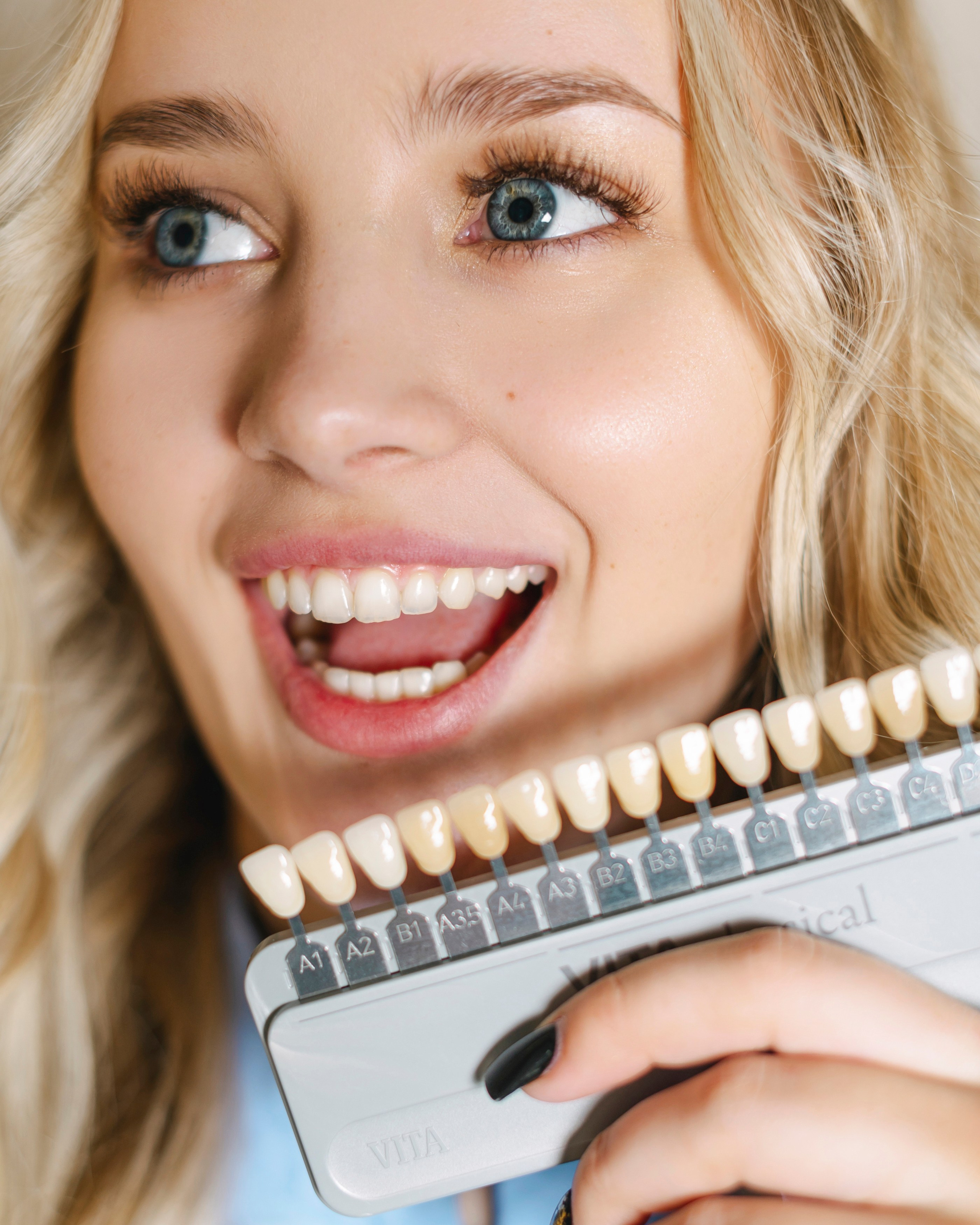 СТОМАТОЛОГИЯ. Шашкова Вероника / Свадебный и семейный фотограф Москва и Ярославль