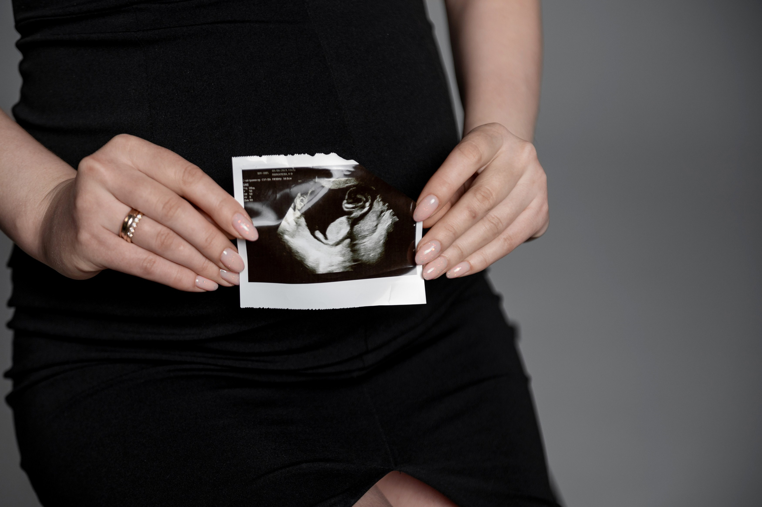 Валерии. Свадебный, семейный и репортажный фотограф. Брянск. Эльвира Голенкова