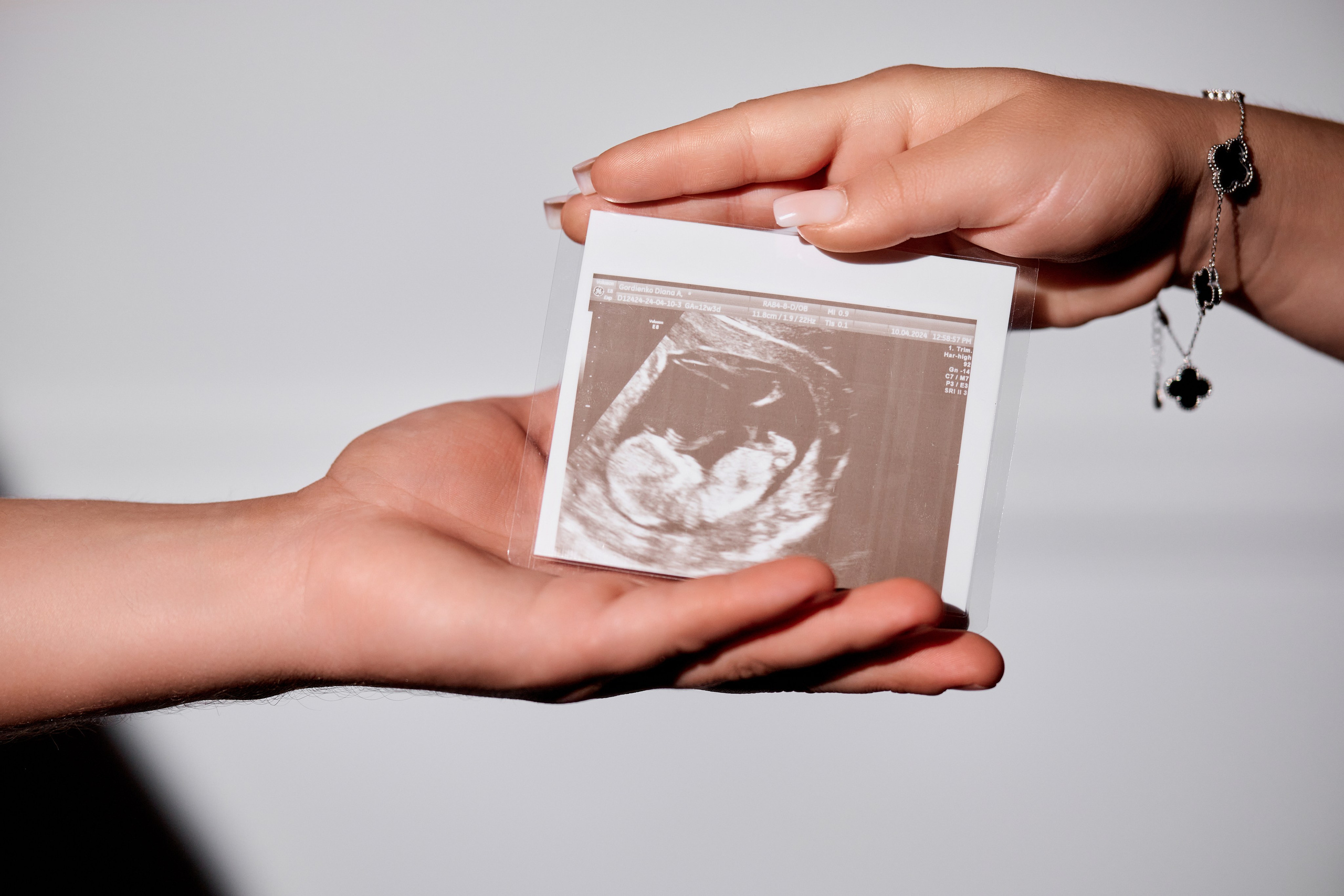 Диана и Витя. Фото студия Luch. Фотограф Таганрог Анна Трайжон