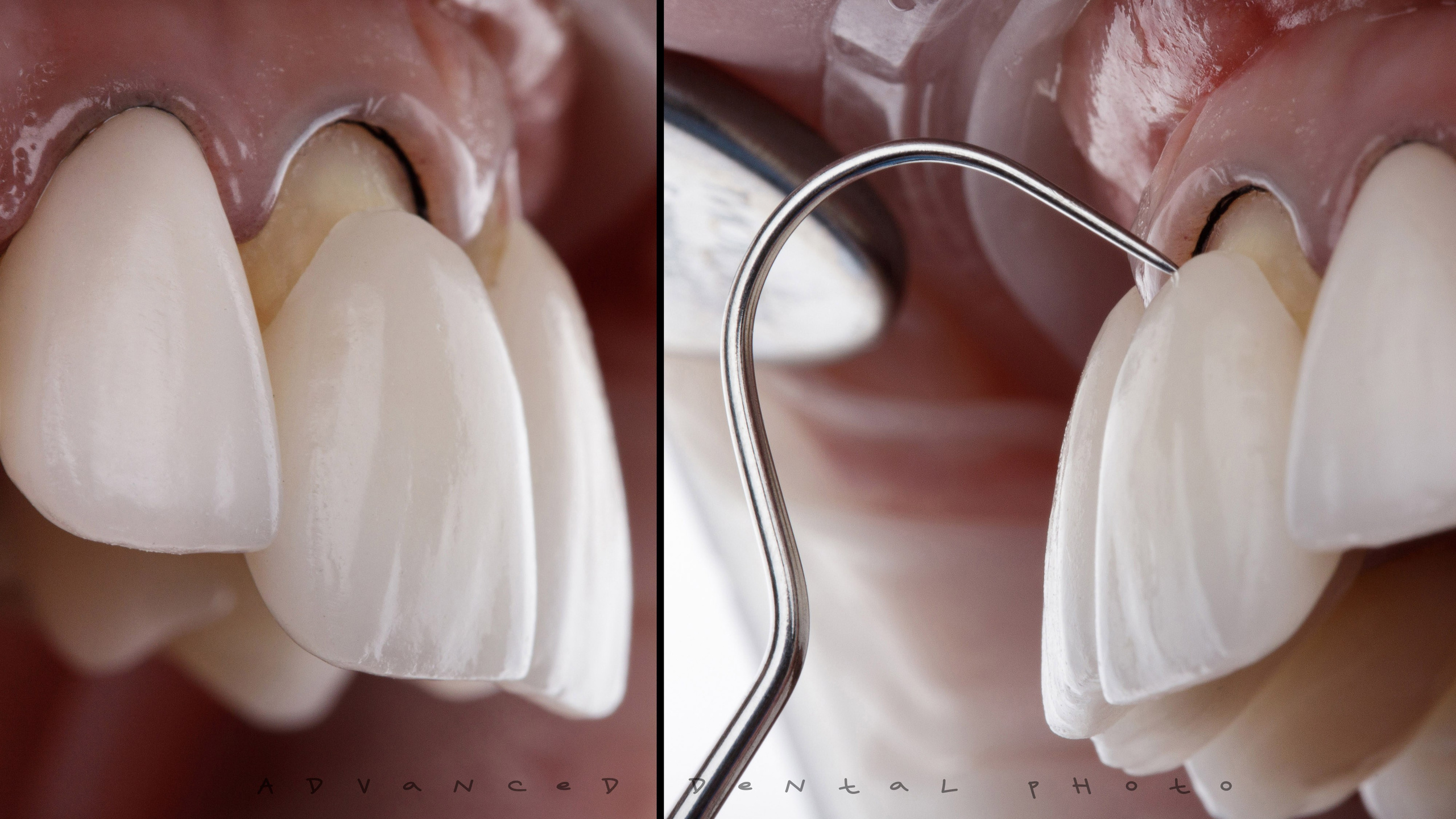 Арт. Дентал фотограф — видеограф Денис Дорошенко