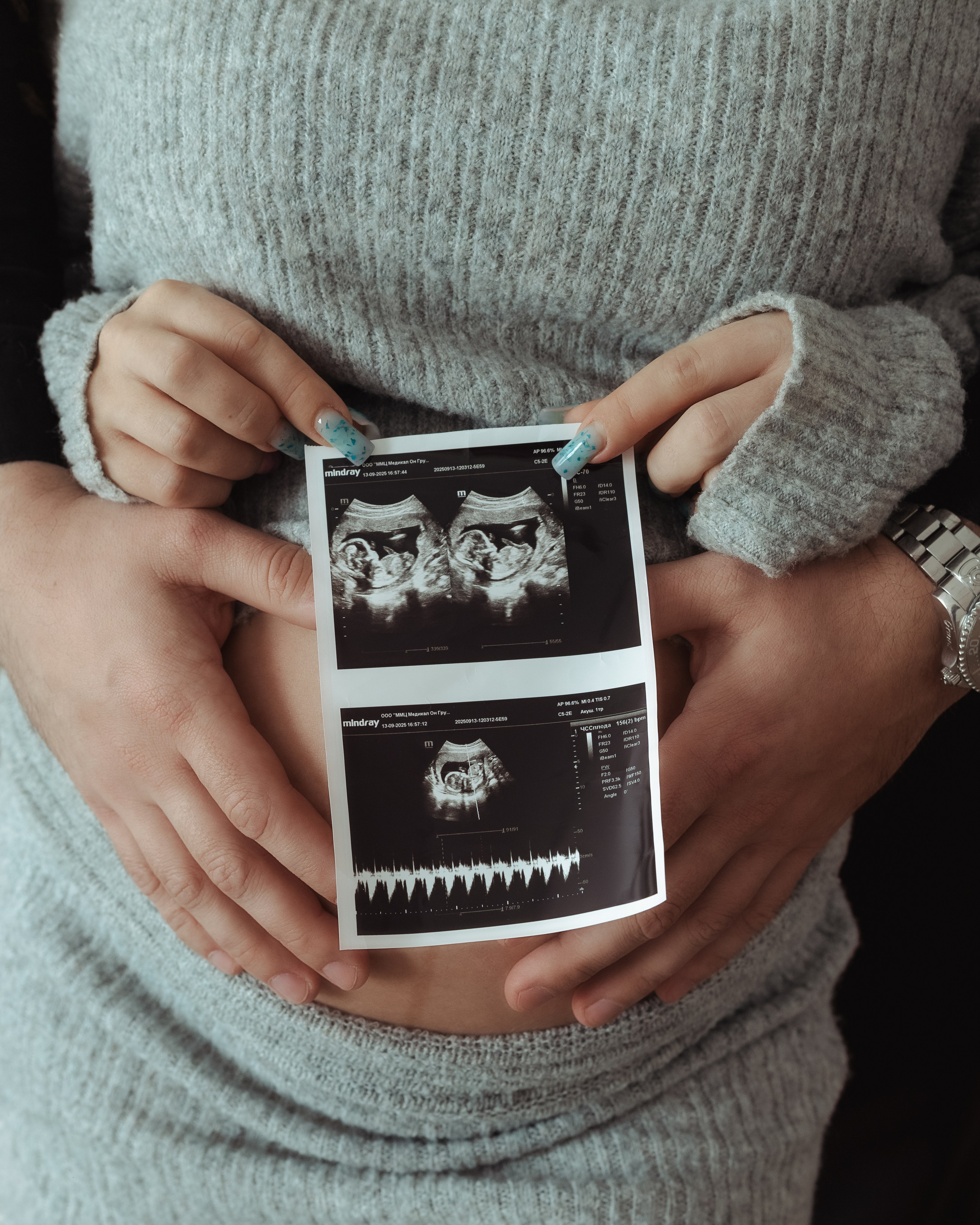 Love story. Photographer