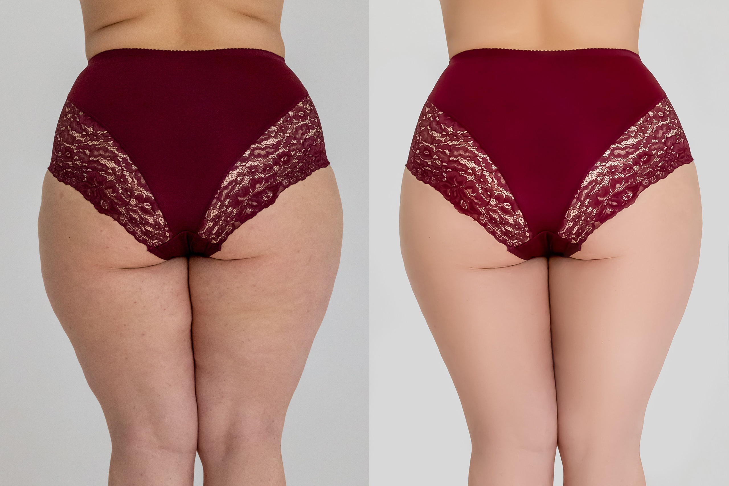 Деликатная обработка портретов для рекламы нижнего белья | Студия SVITHART