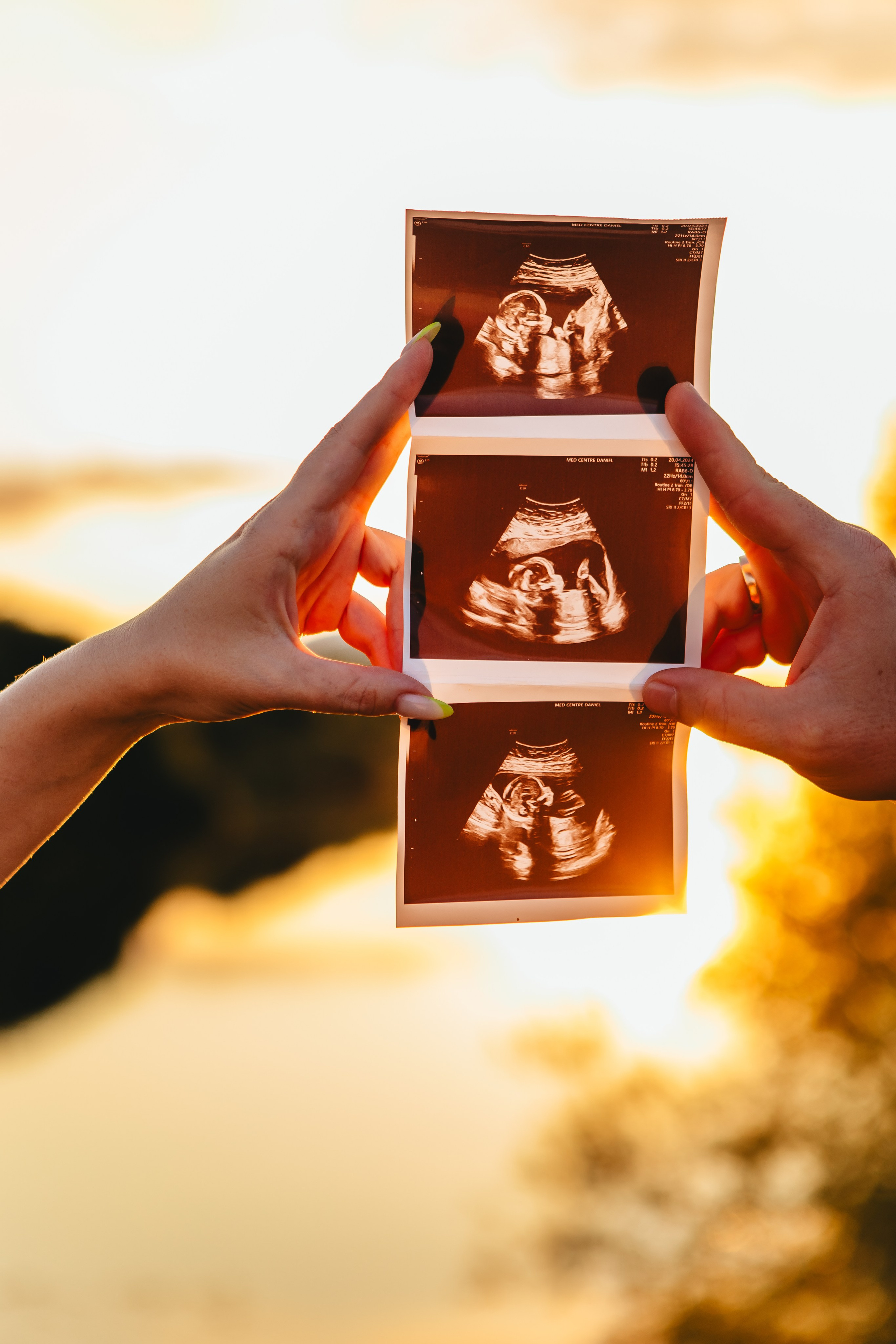 Тепло будущего. Семейный и свадебный фотограф Сочи Адлер Сириус Красная поляна