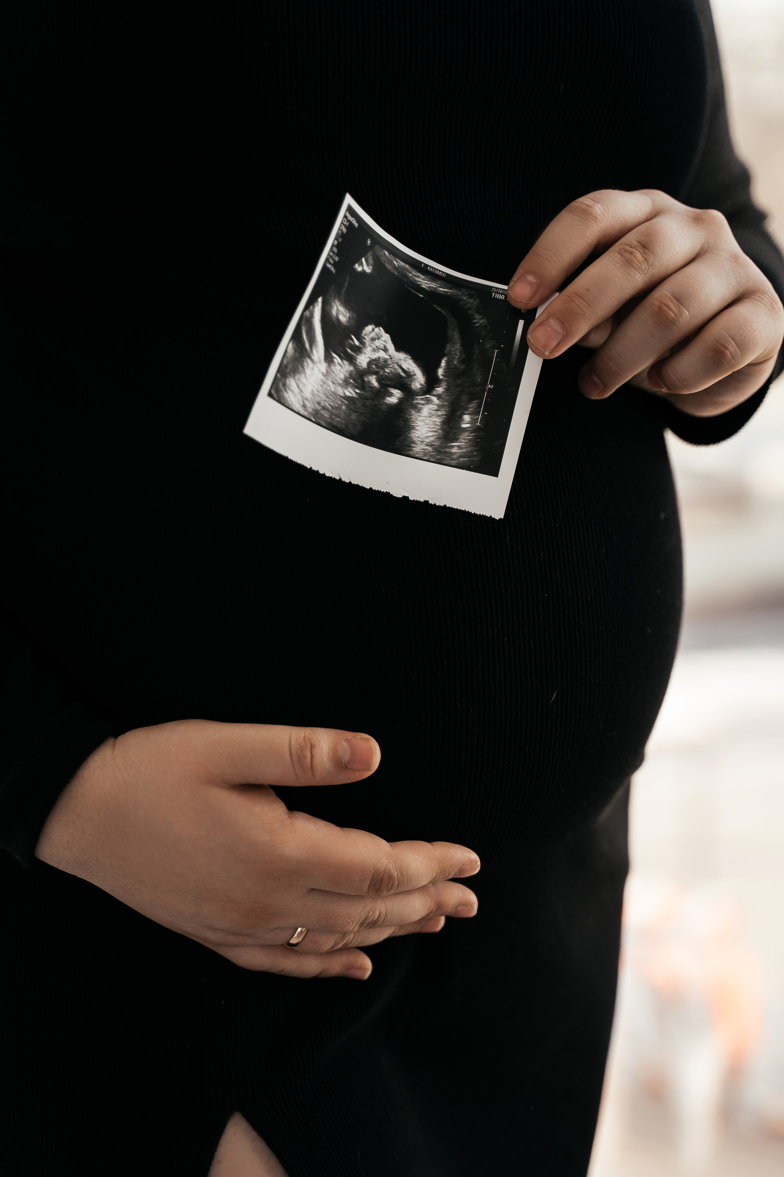 Лёша и Алёна. Моменты и истории о вас настоящих