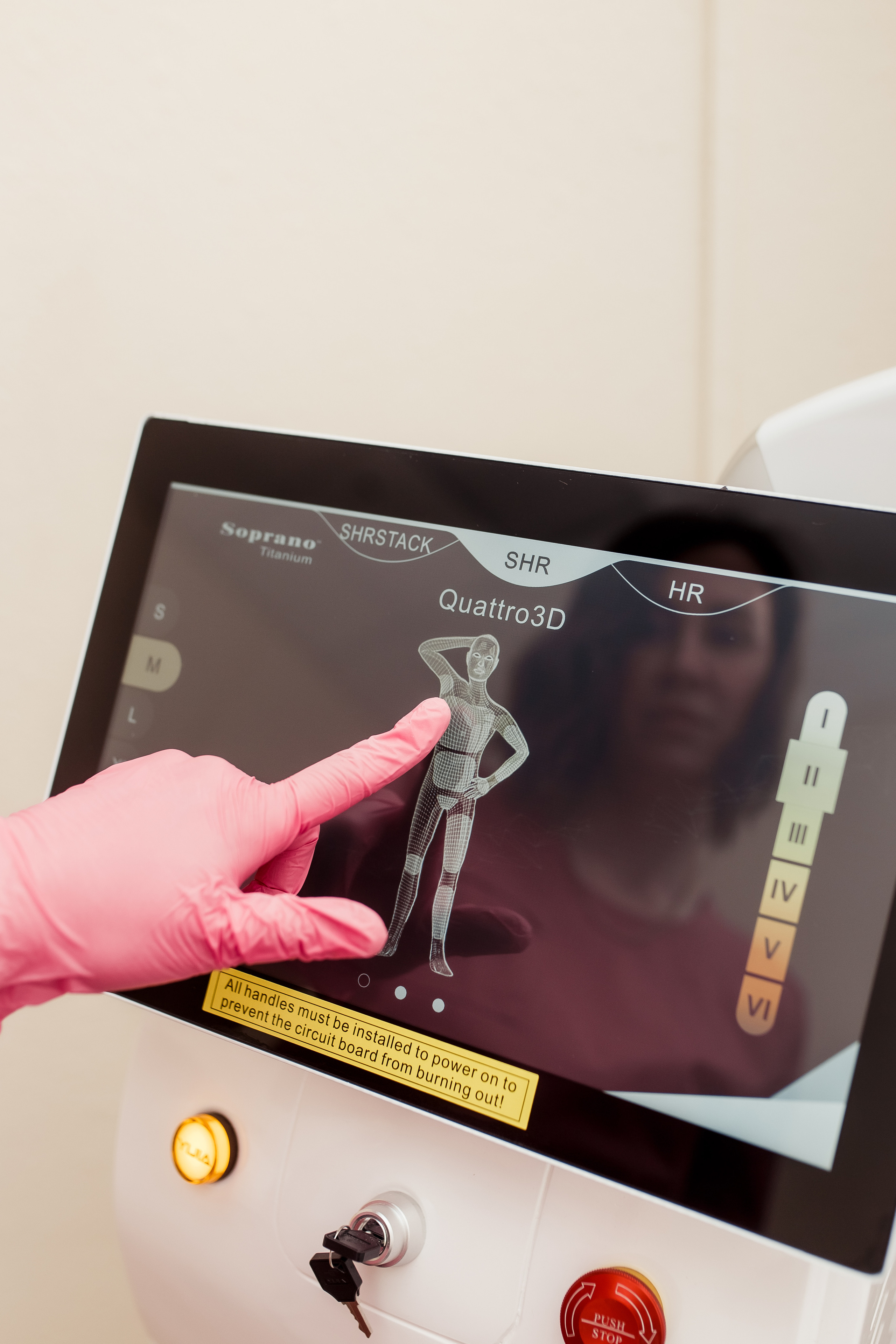 Дарья. Лазерная эпиляция